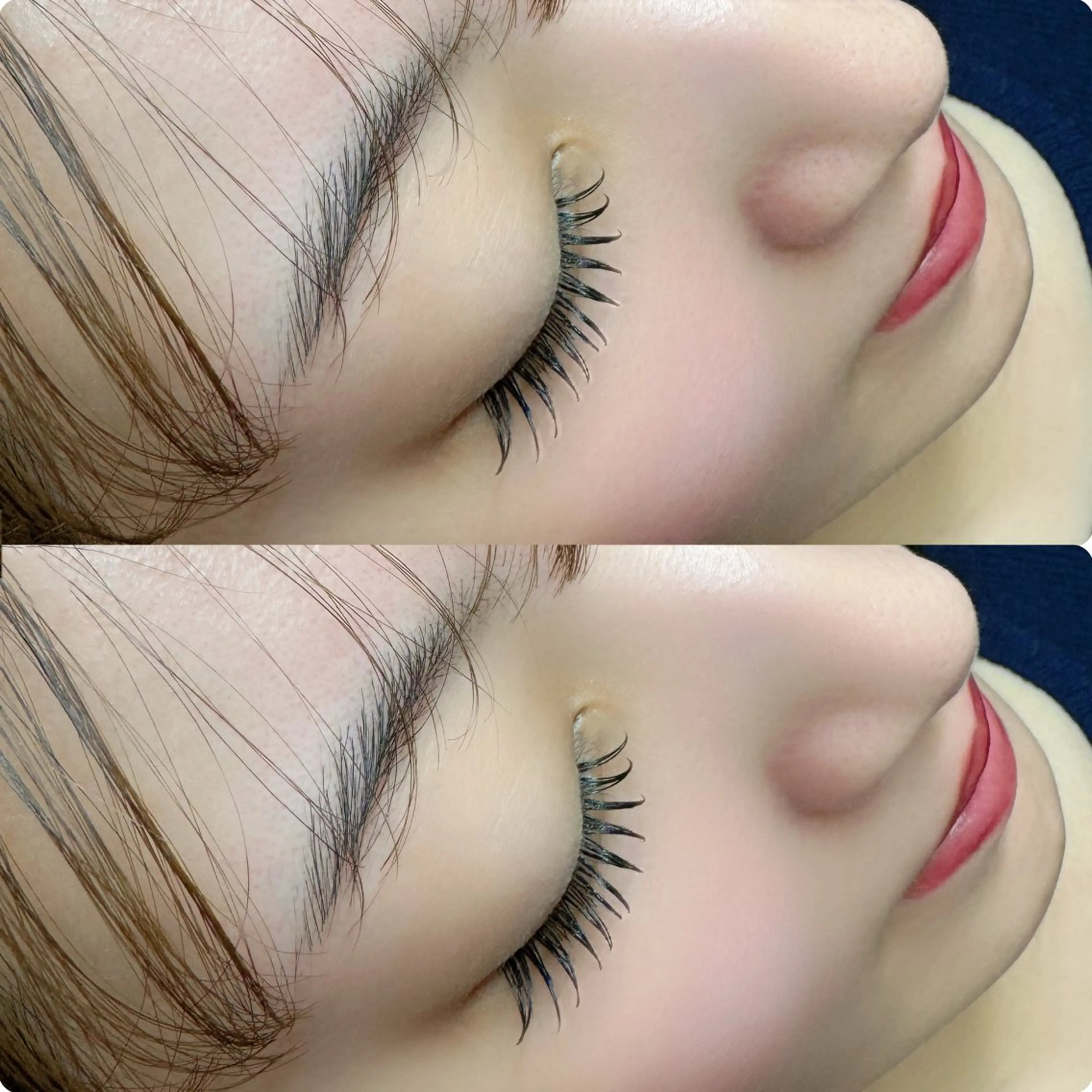 【フラットラッシュ100本】の写真