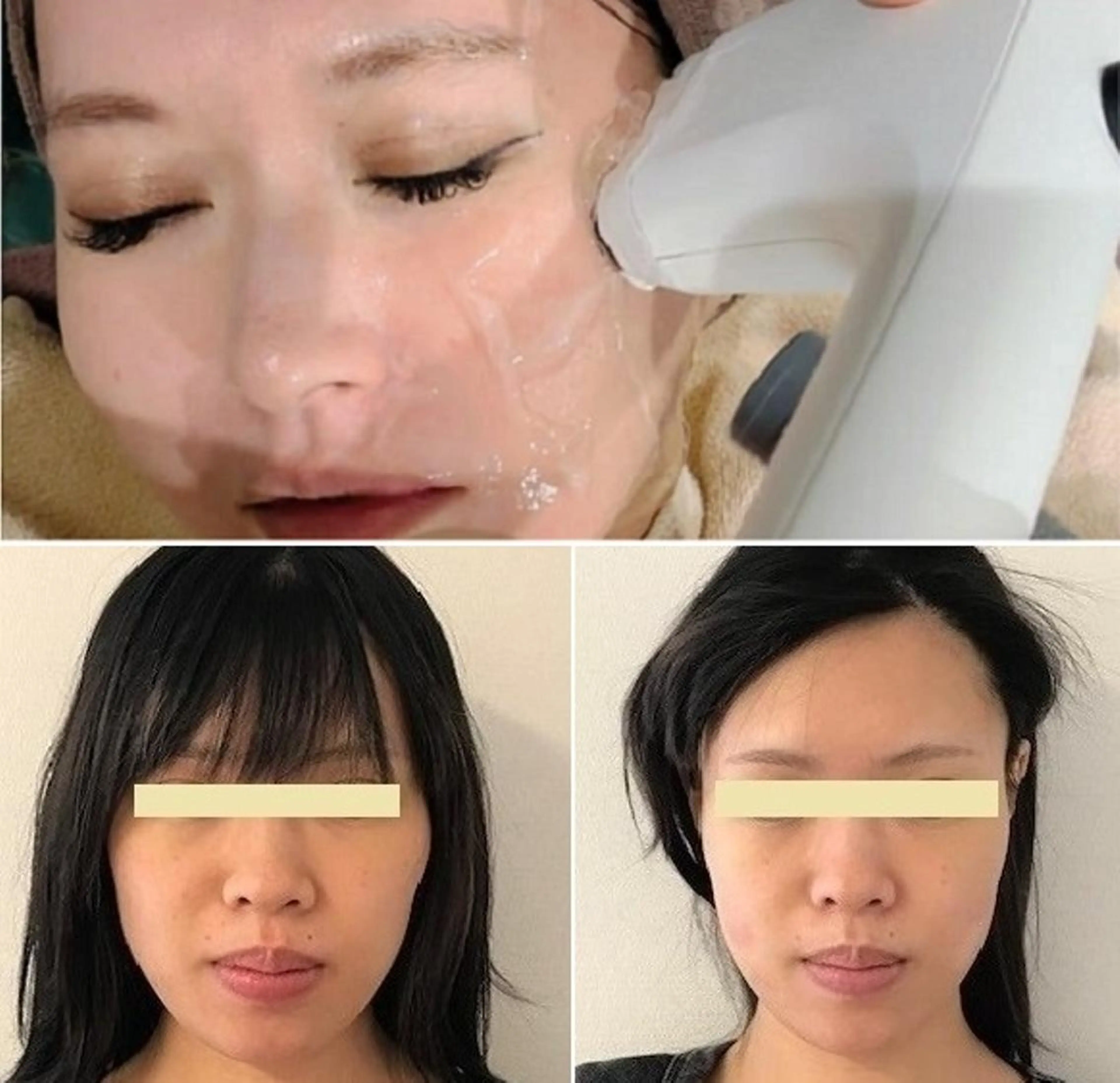 エステ 全身脱毛＆VIO脱毛 紹介率№1♪リナ♪のエステ・リラクイメージ