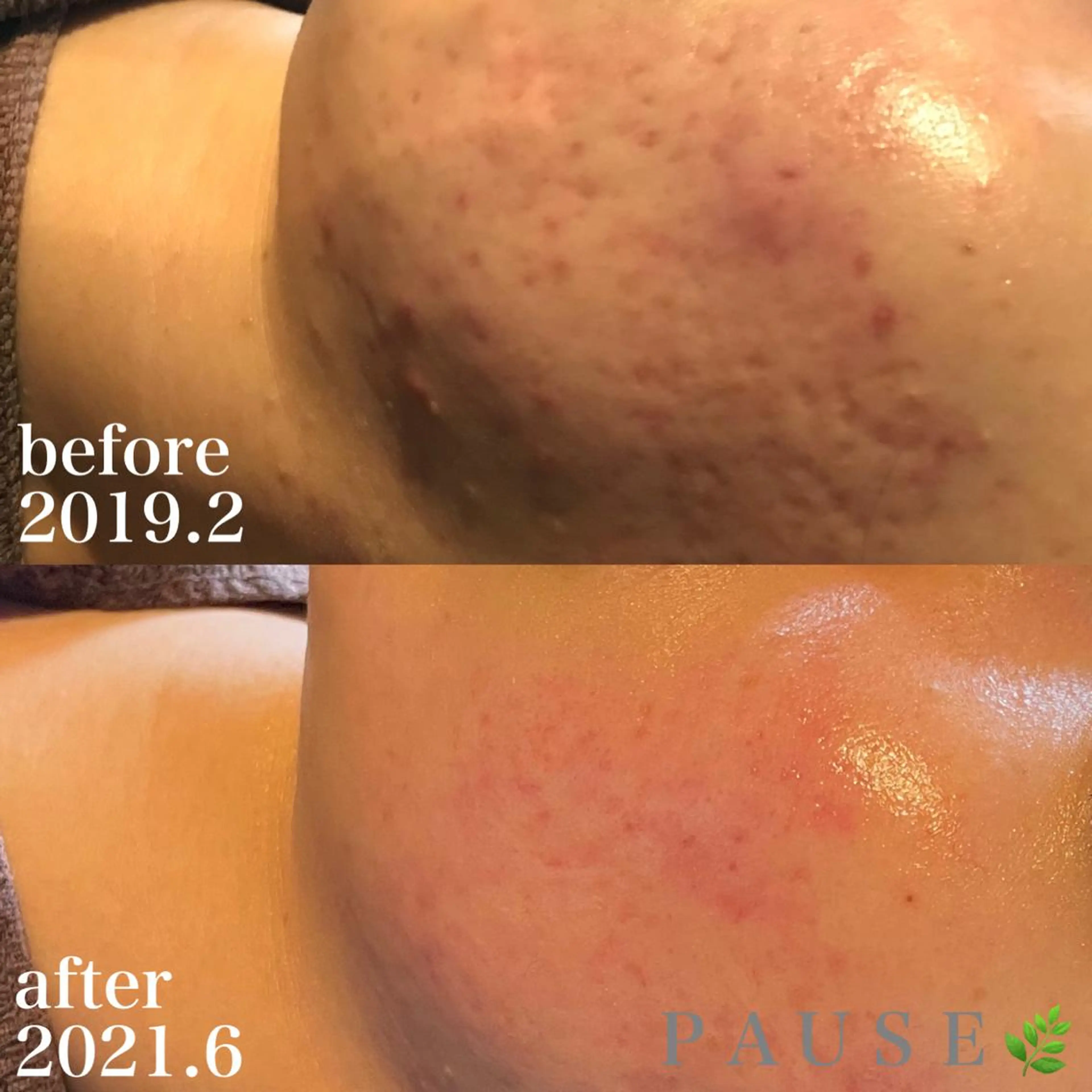 エステ リラク 浜野 恵美のエステ・リラクイメージ