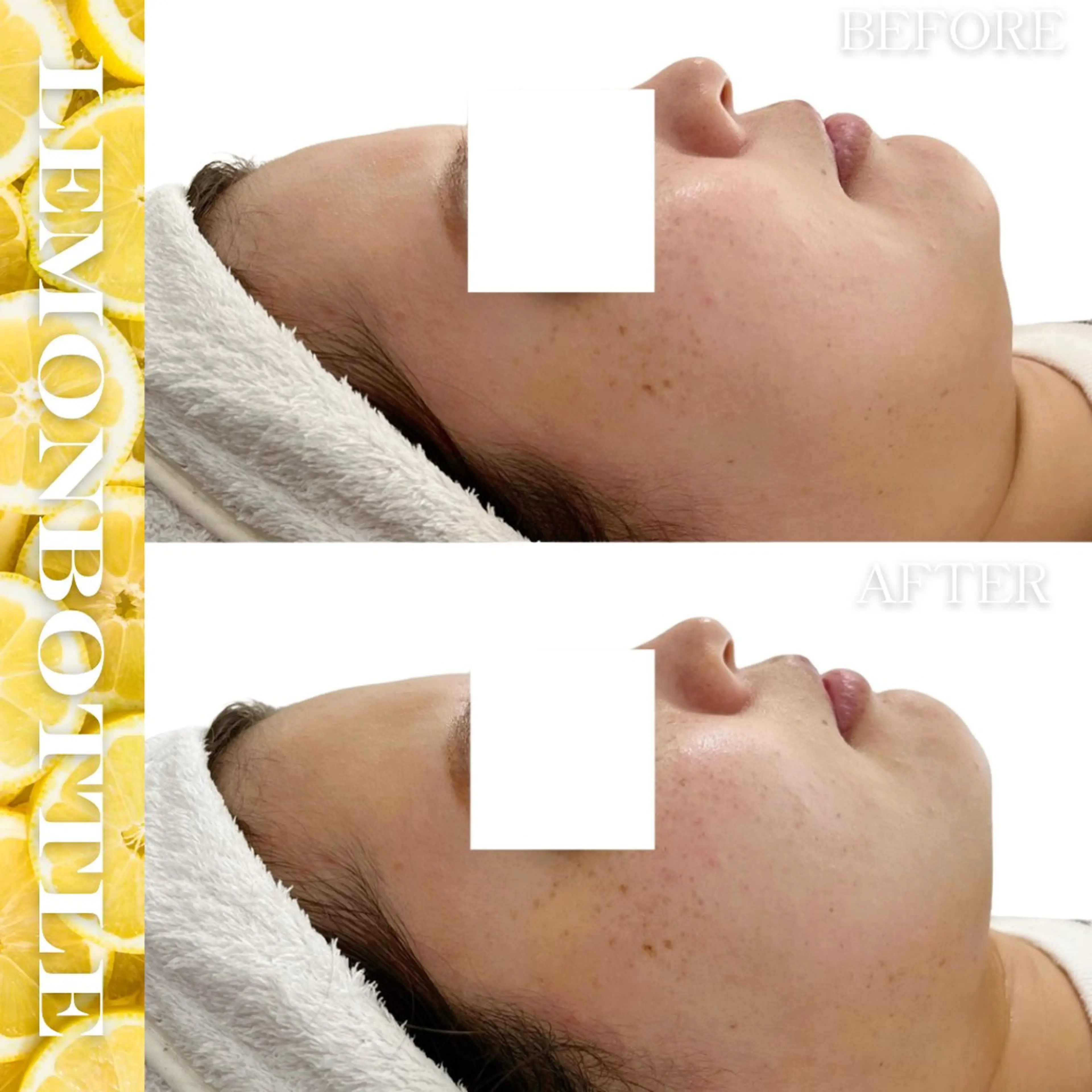 その他 Liam《美肌管理/ 3D小顔/脂肪ケア》のエステ・リラクイメージ