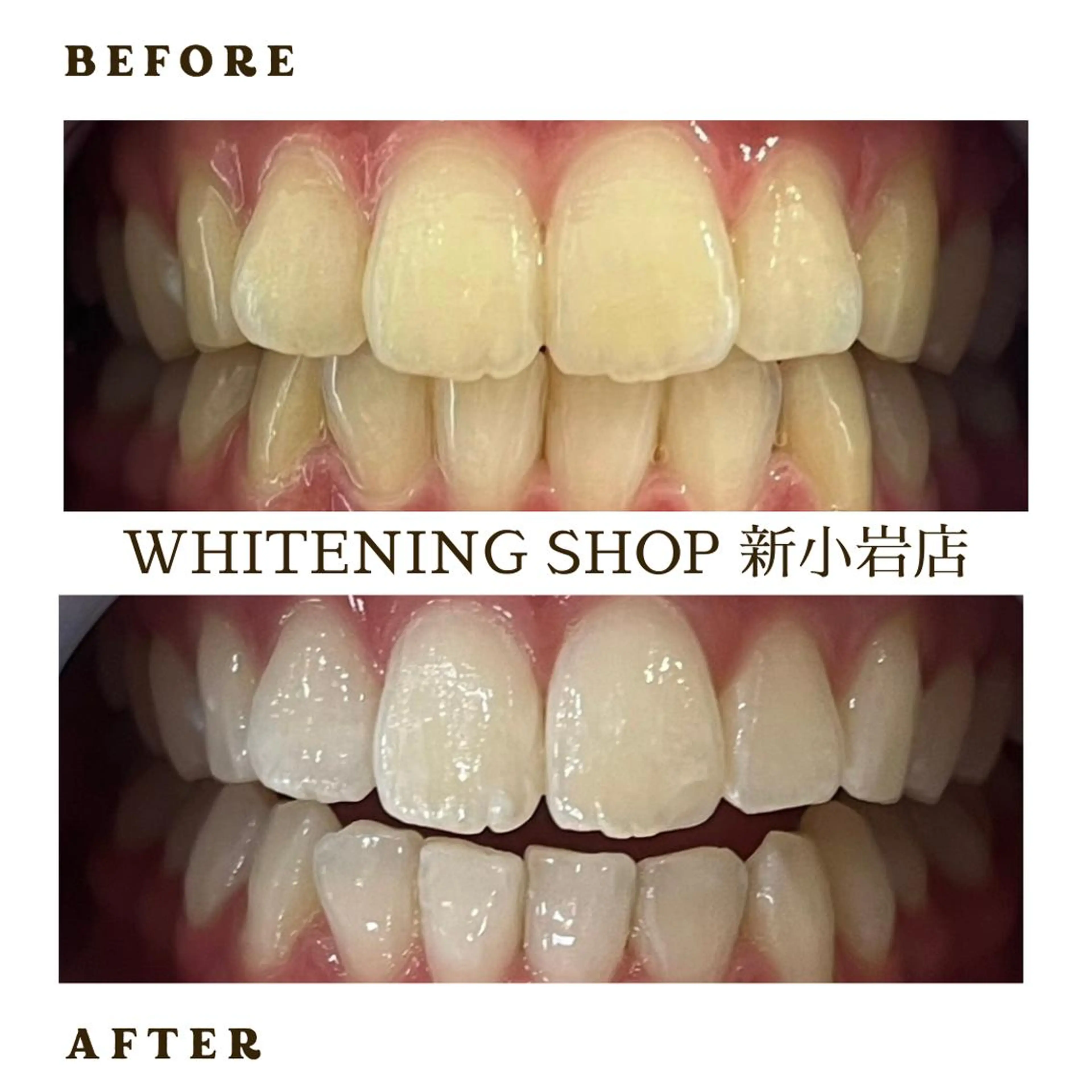 メンズ その他 ホワイトニング ショップ新小岩店のその他イメージ