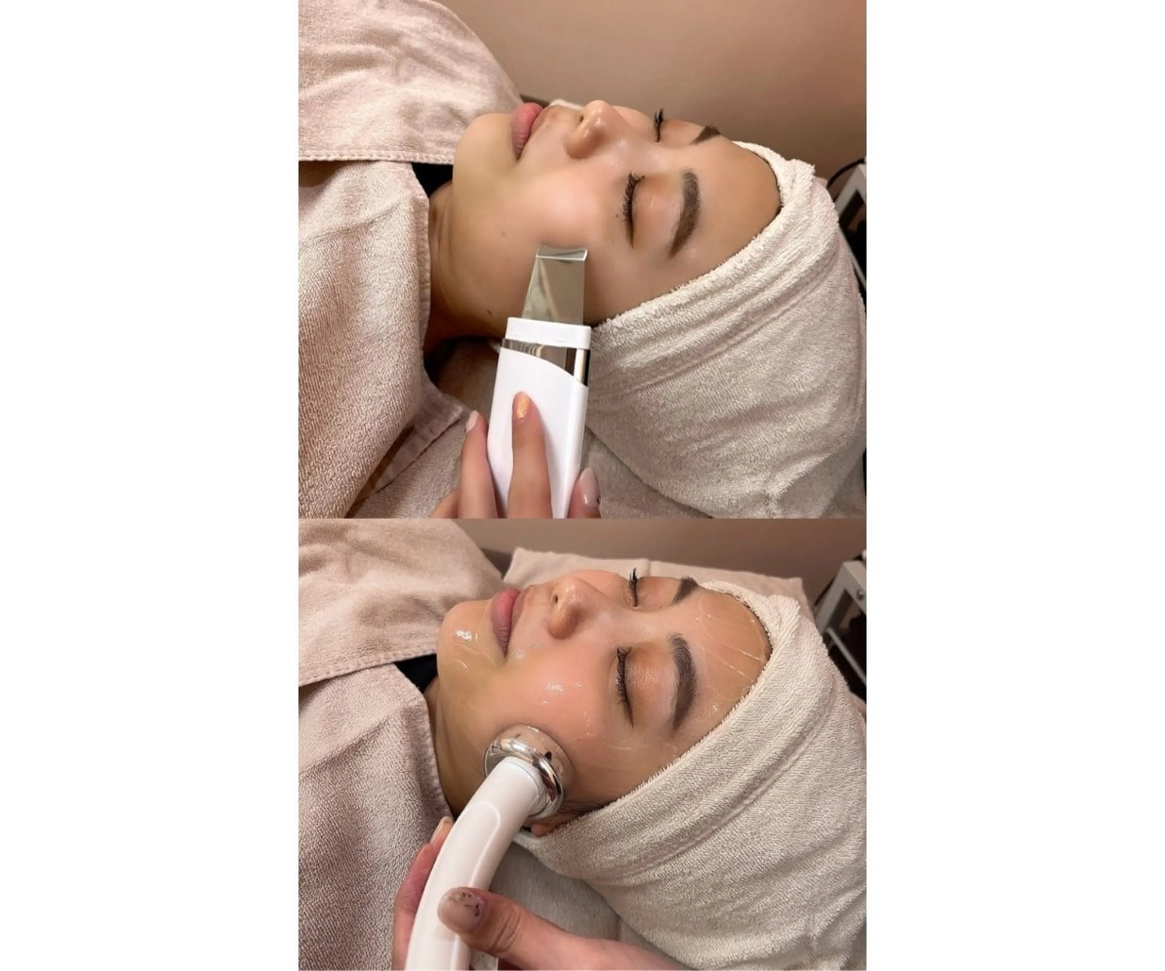 18​〜​22歳限定🎓　毛穴撃退セットメニュー⭐️黒ずみや角栓詰まり、ざらつきに⭐️の写真