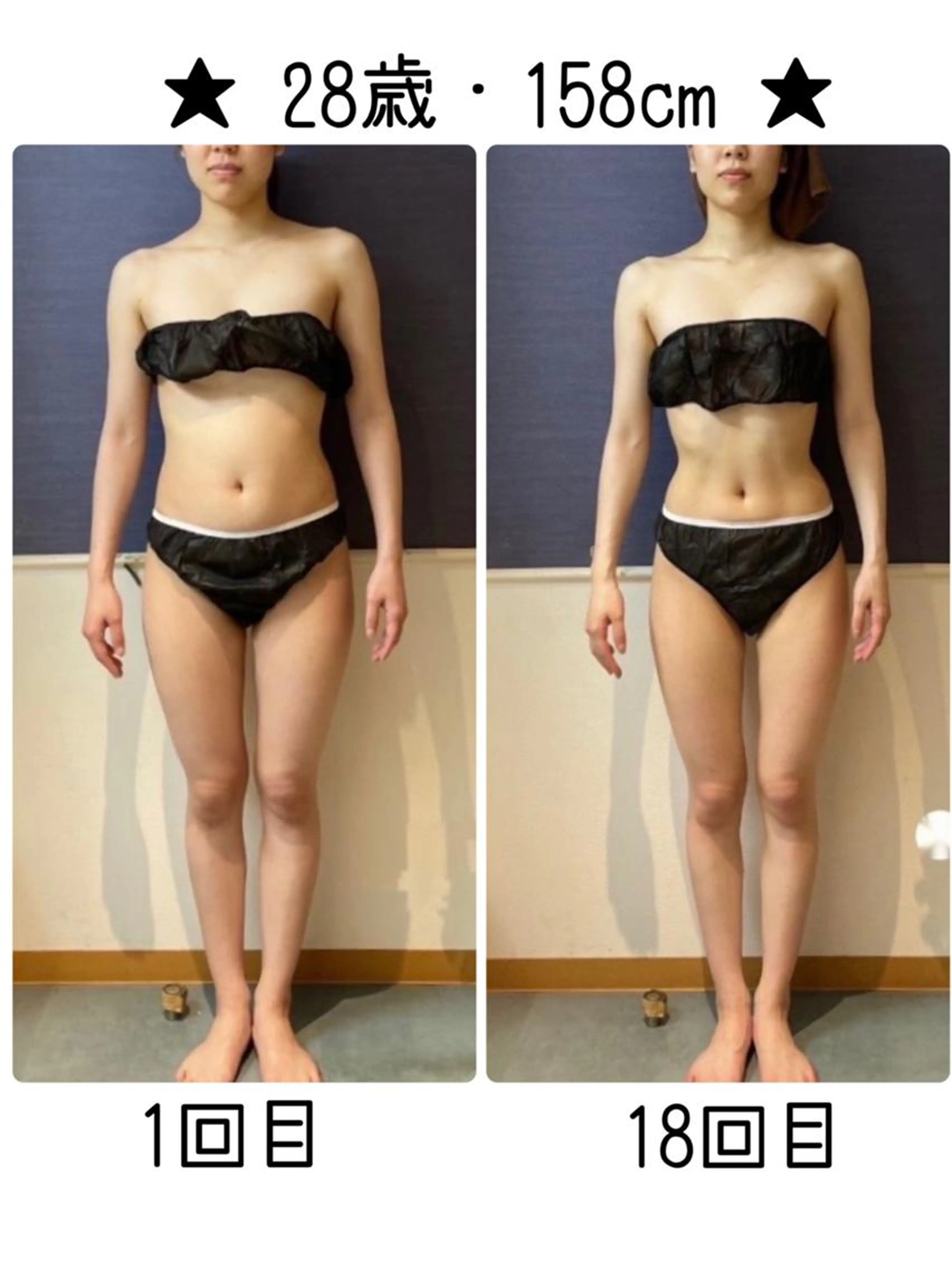 【今がチャンス★2回セット】90分 全身筋膜リンパデトックス痩身×2回　￥15400-（税込）の写真