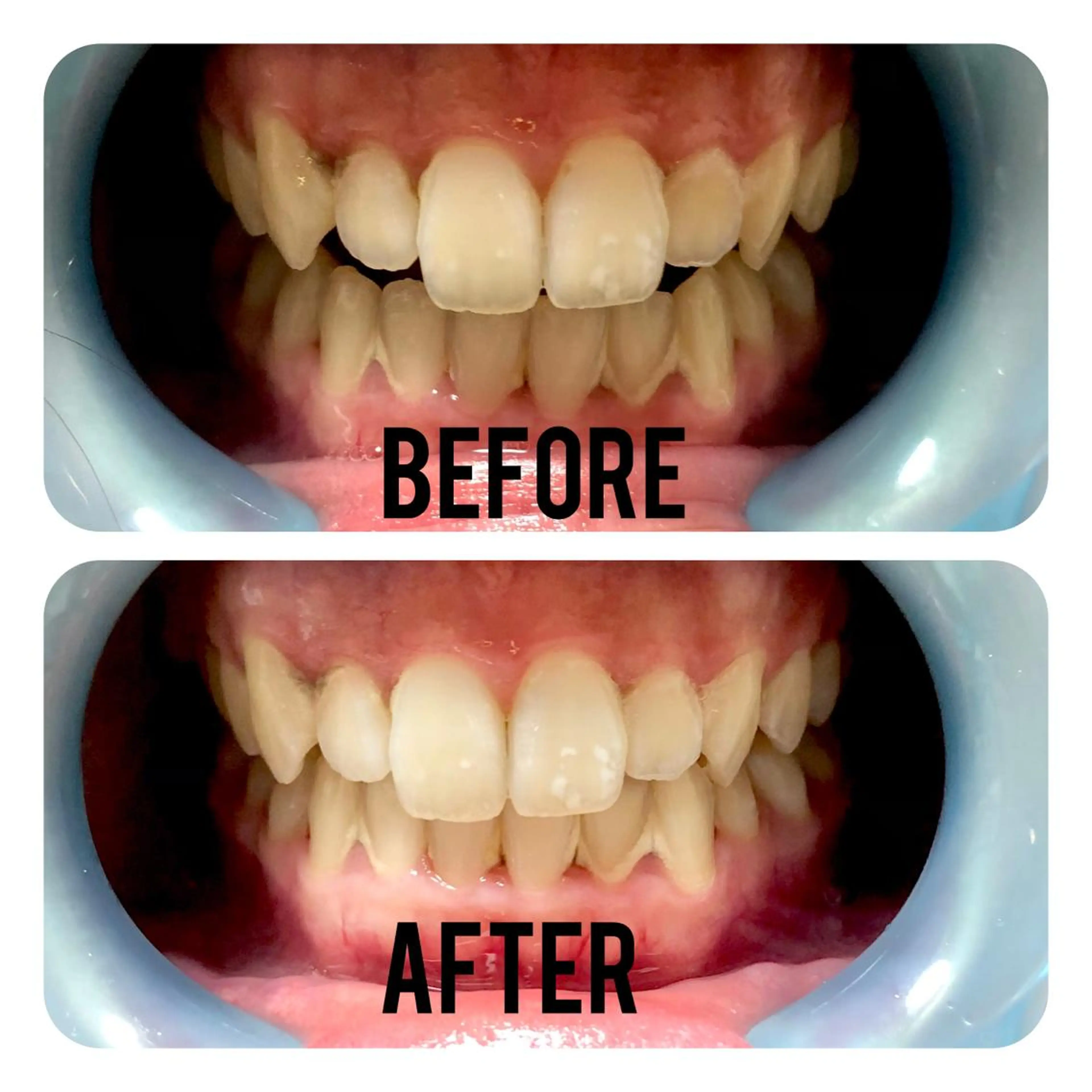 その他 two nailのネイルデザイン