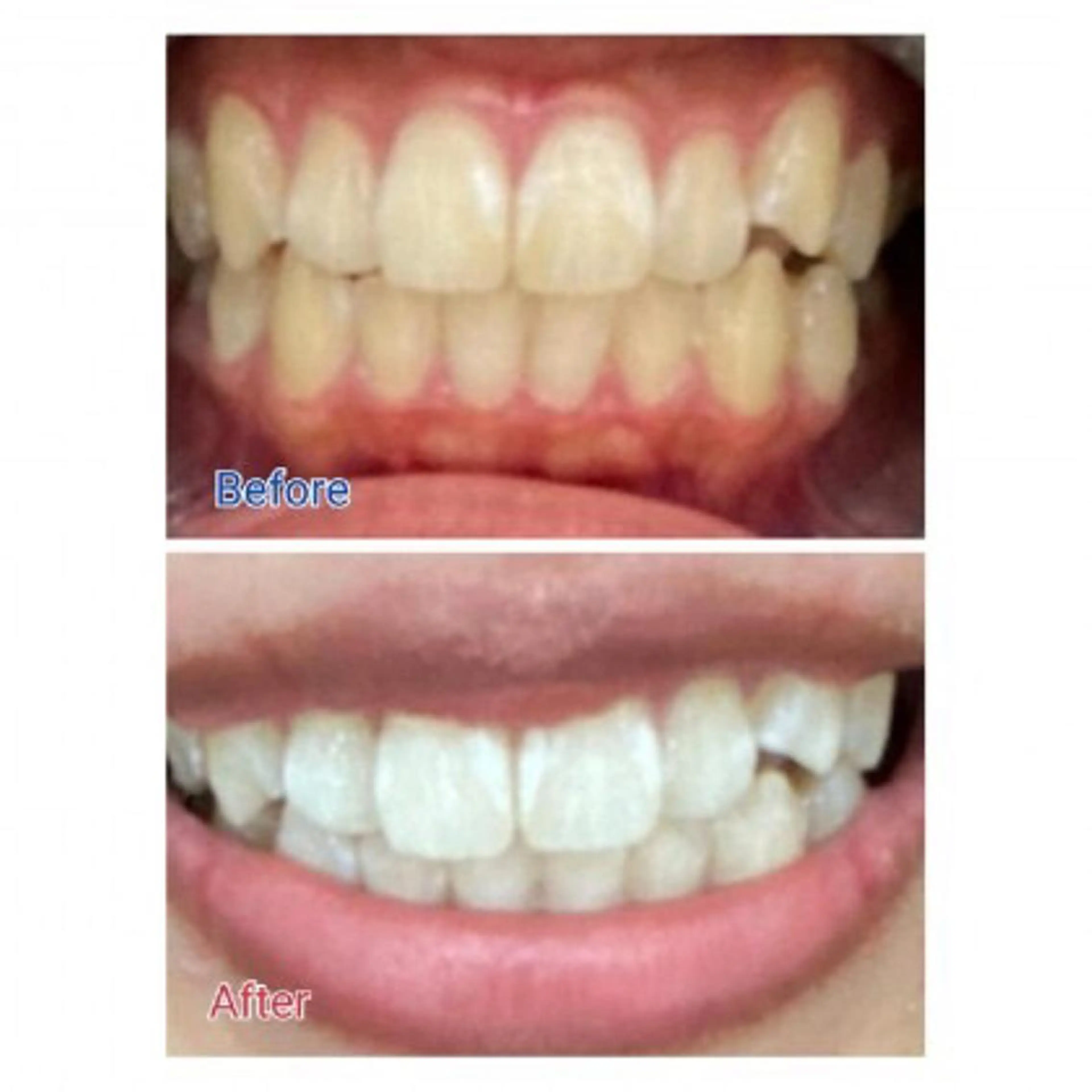 M渋谷店所属・Ｍ渋谷 ホワイトニングのエステ・リラクイメージ