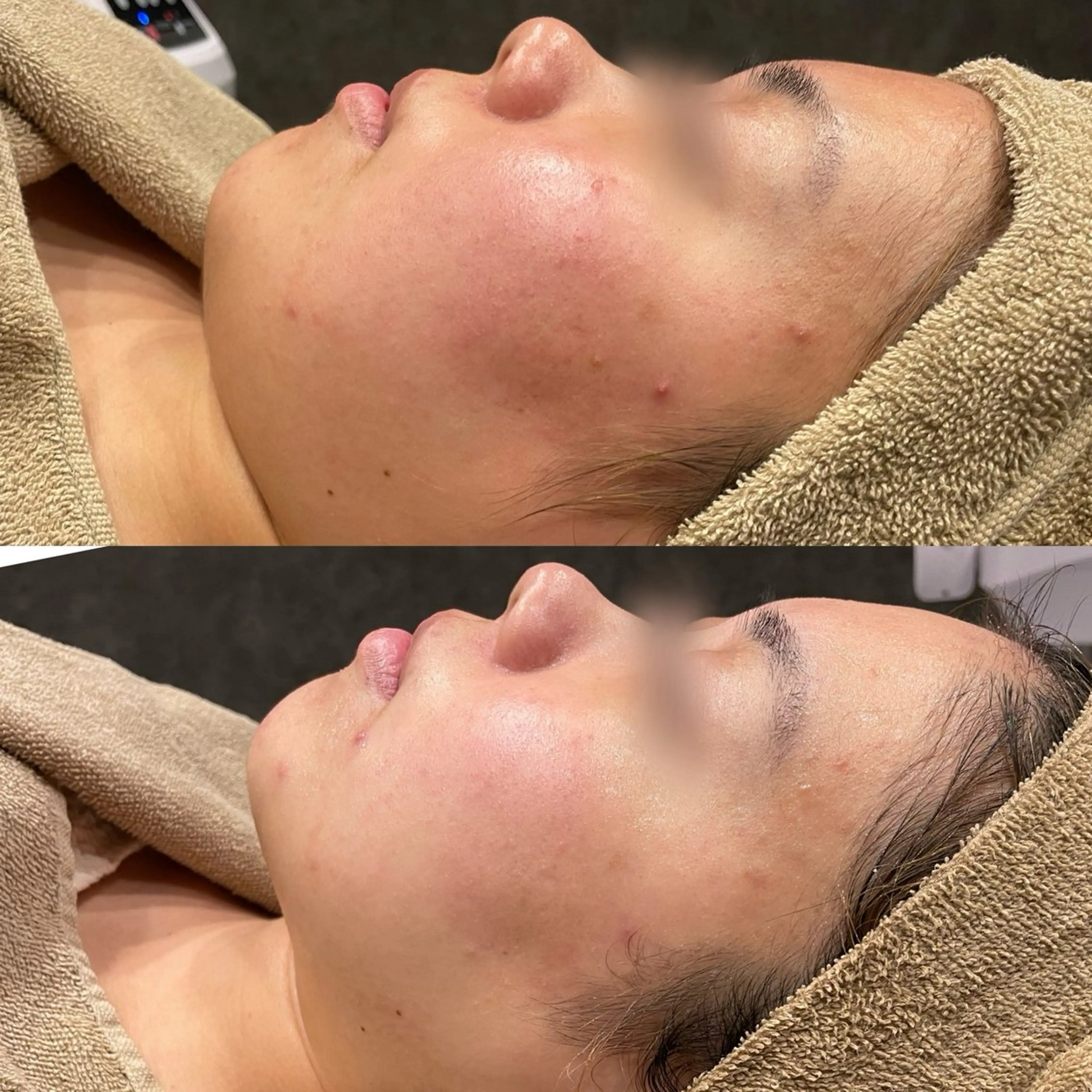 エステ Re:Belle所属・Re:Belle 久留米 : 中島のエステ・リラクイメージ