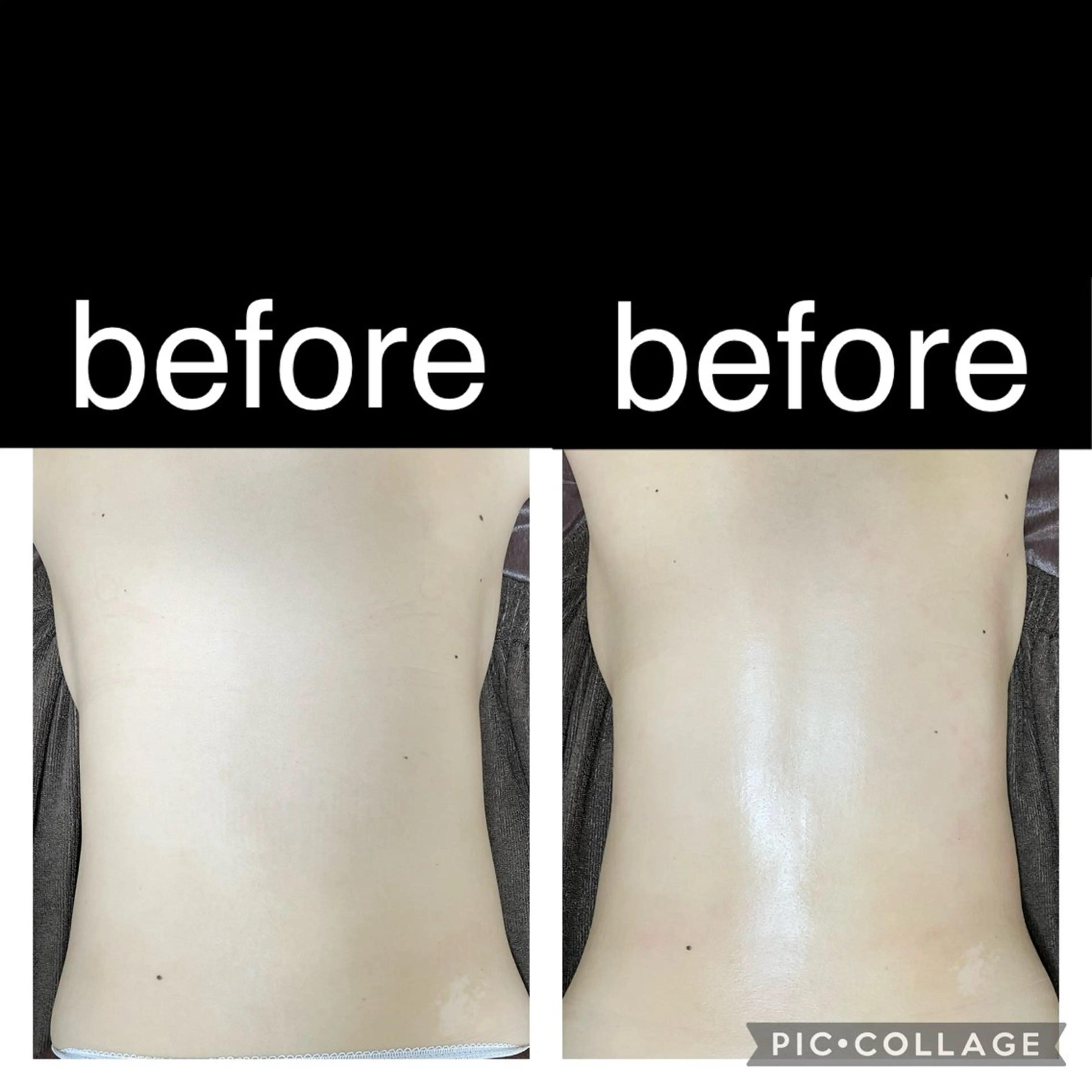 【ミニモ口コミ+他口コミ1件】オイル筋膜剥がしエステ◎もも張り・ウエストダウン・デコルテバストアップ♪60分4400円の写真