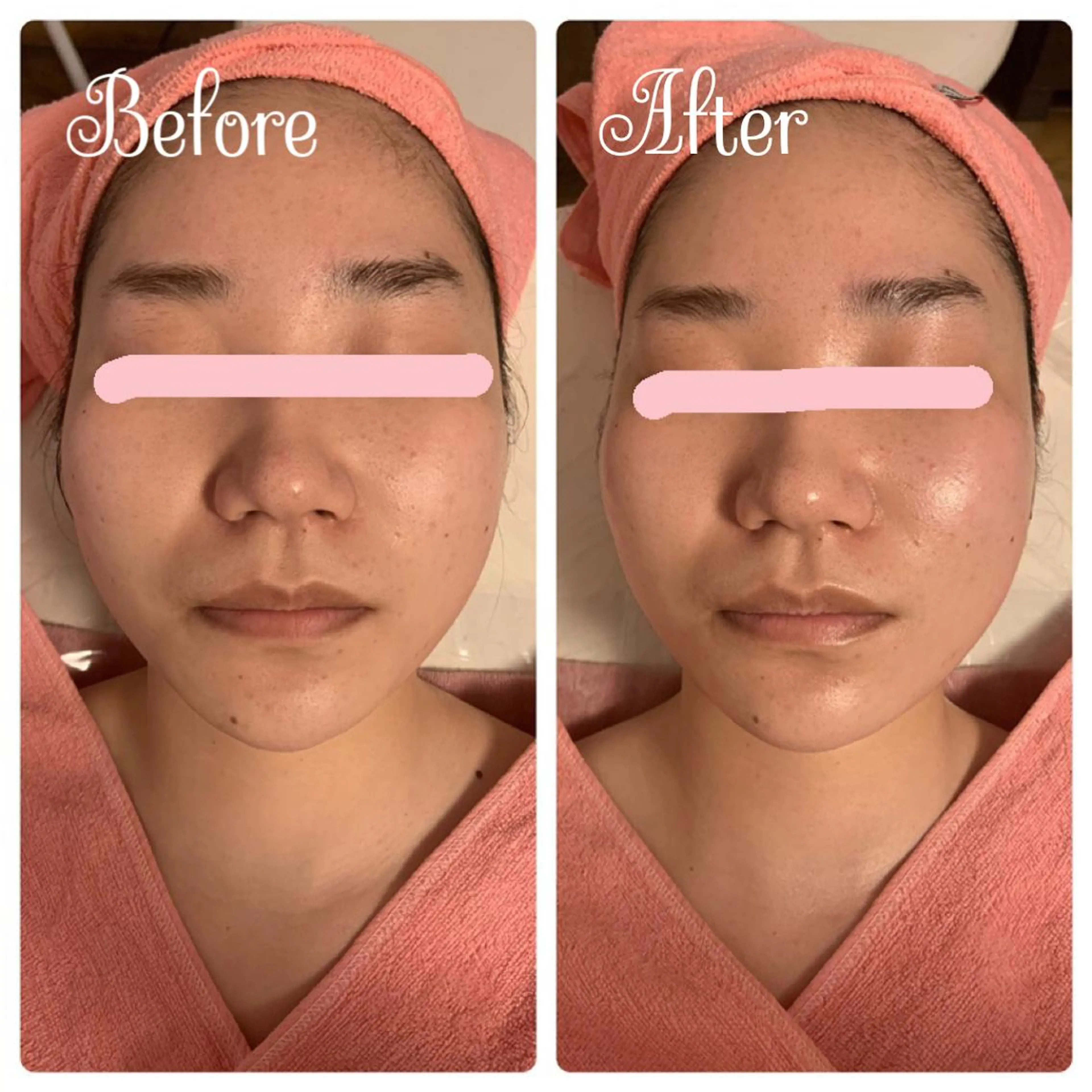 エステ リラク 透明感の肌Lino malieのエステ・リラクイメージ