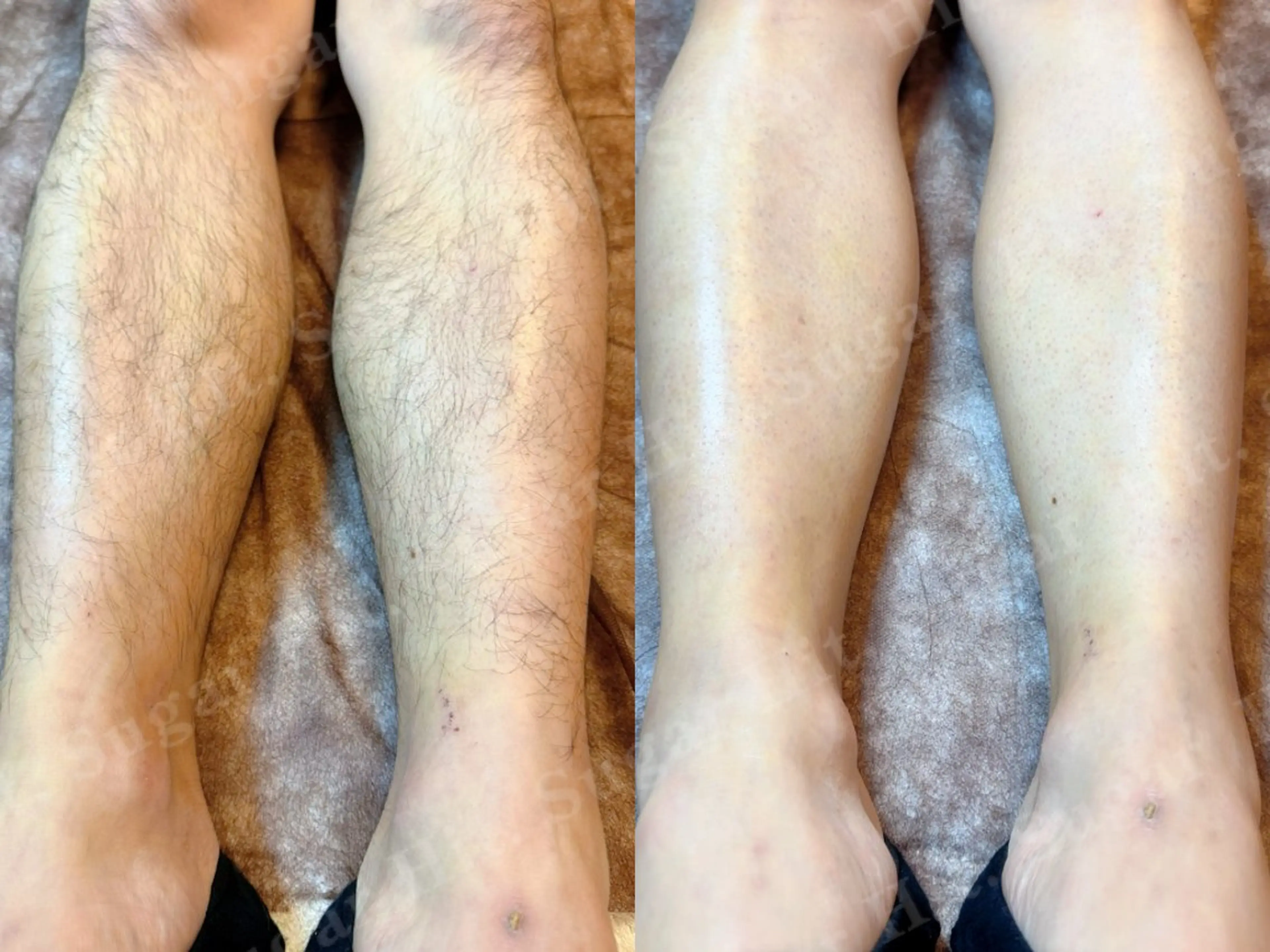 Hit. シュガーリング豊橋のエステ・リラクイメージ