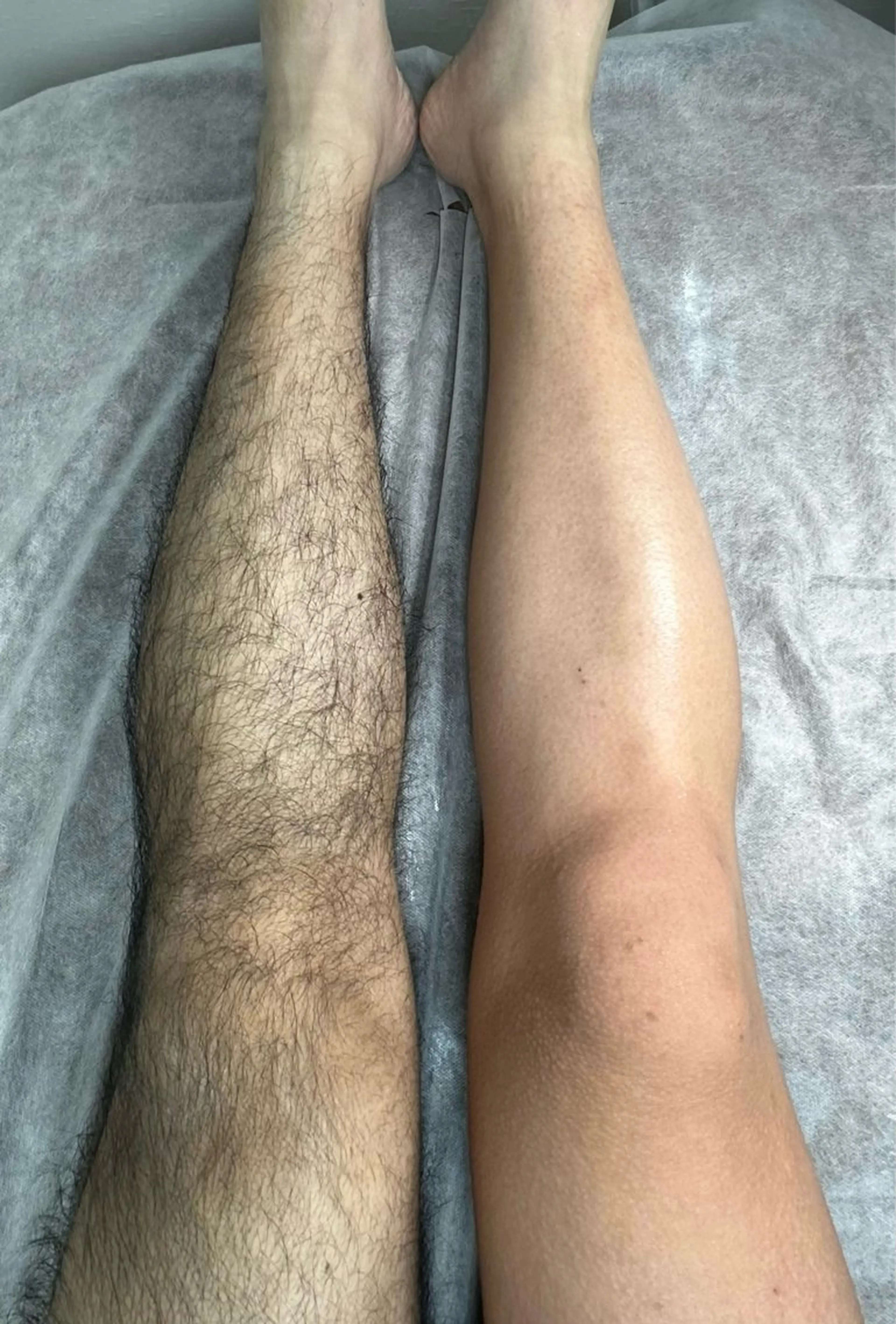 メンズ 脱毛 LULA大宮店 YOSHIWARAの眉毛・アイブロウイメージ