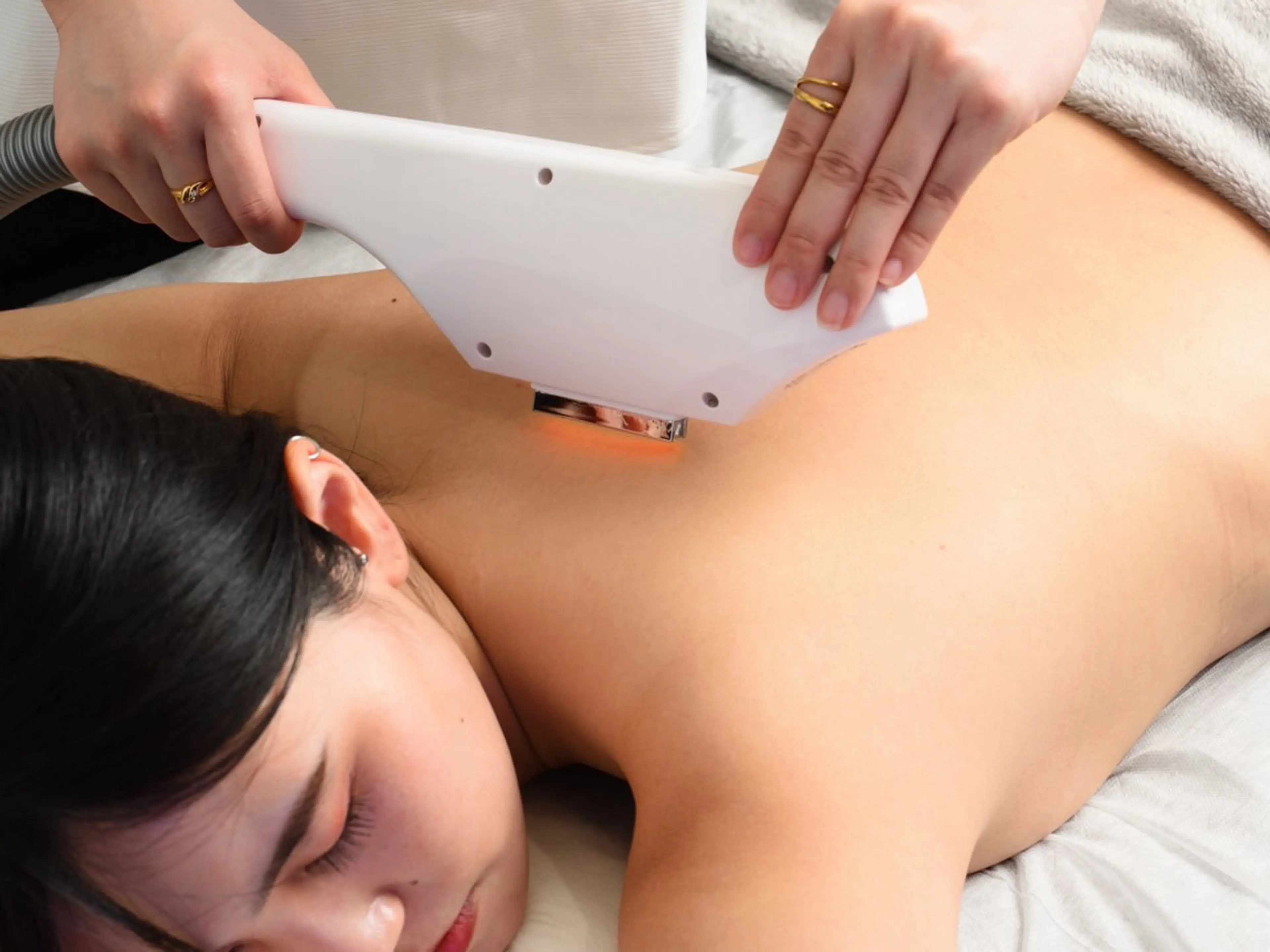 【火・水曜日だけのスペシャルプライス🔥】☆レディース☆全身まるごと脱毛(顔VIO込)最先端コラーゲン美肌脱毛!の写真