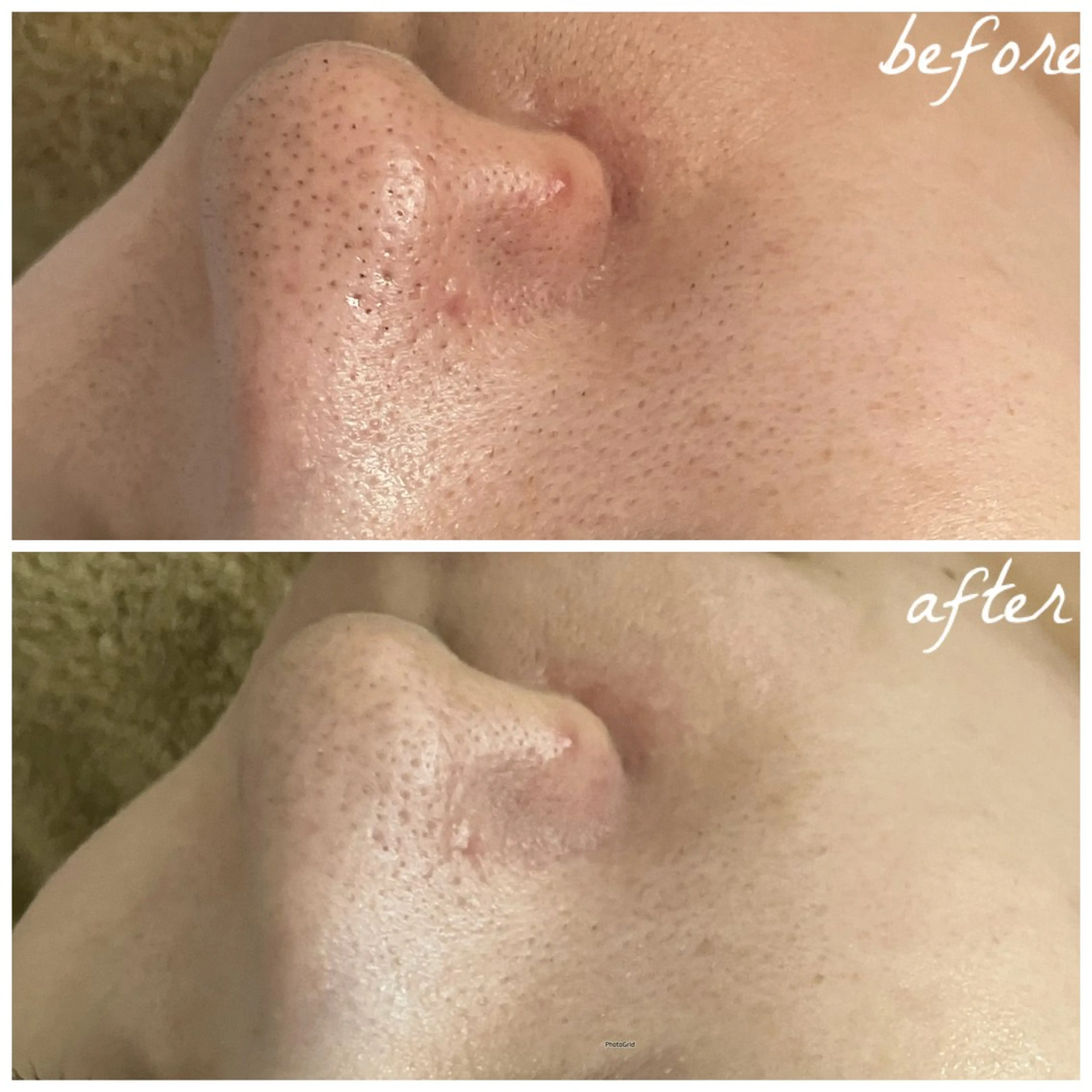 メンズ メナード岐阜茜部 杉浦のエステ・リラクイメージ