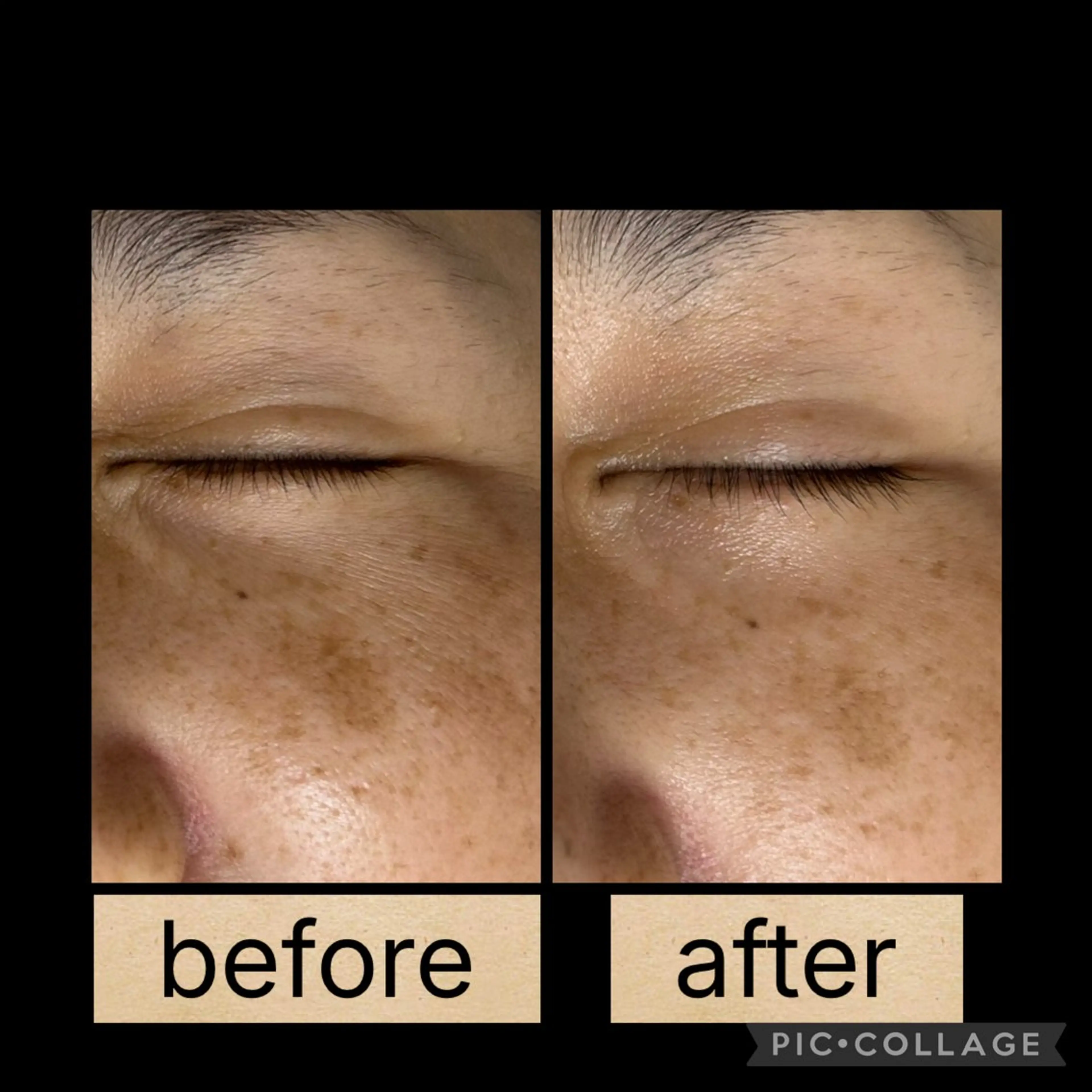 DeI'm柴田所属・【肌質改善サロン】 Harunaのネイルデザイン