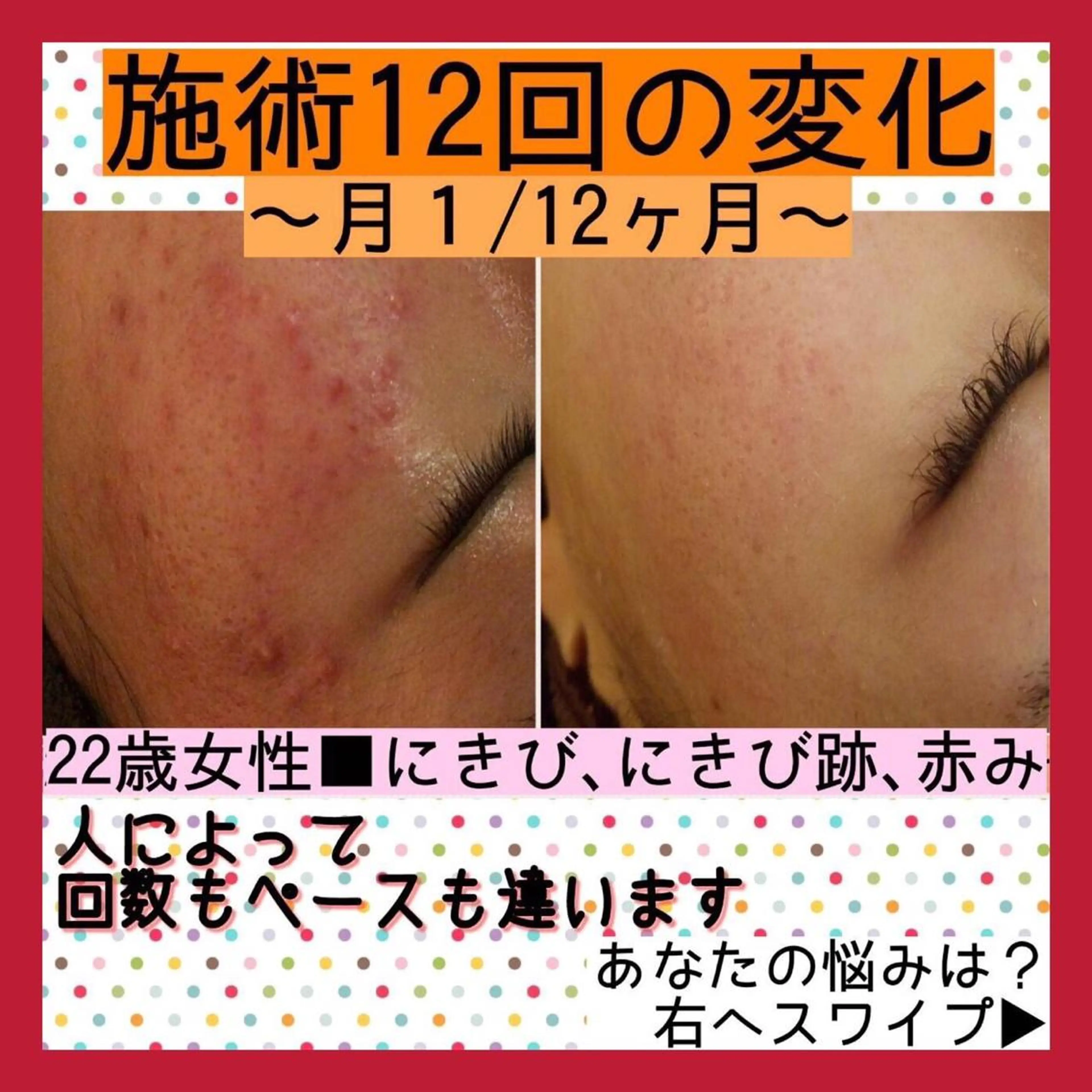 ミディアム カラー パーマ ヘアアレンジ メンズ キッズ ネイル マツエク・マツパ ニキビ・肌質改善専門 ♡人生が変わるサロンのエステ・リラクイメージ