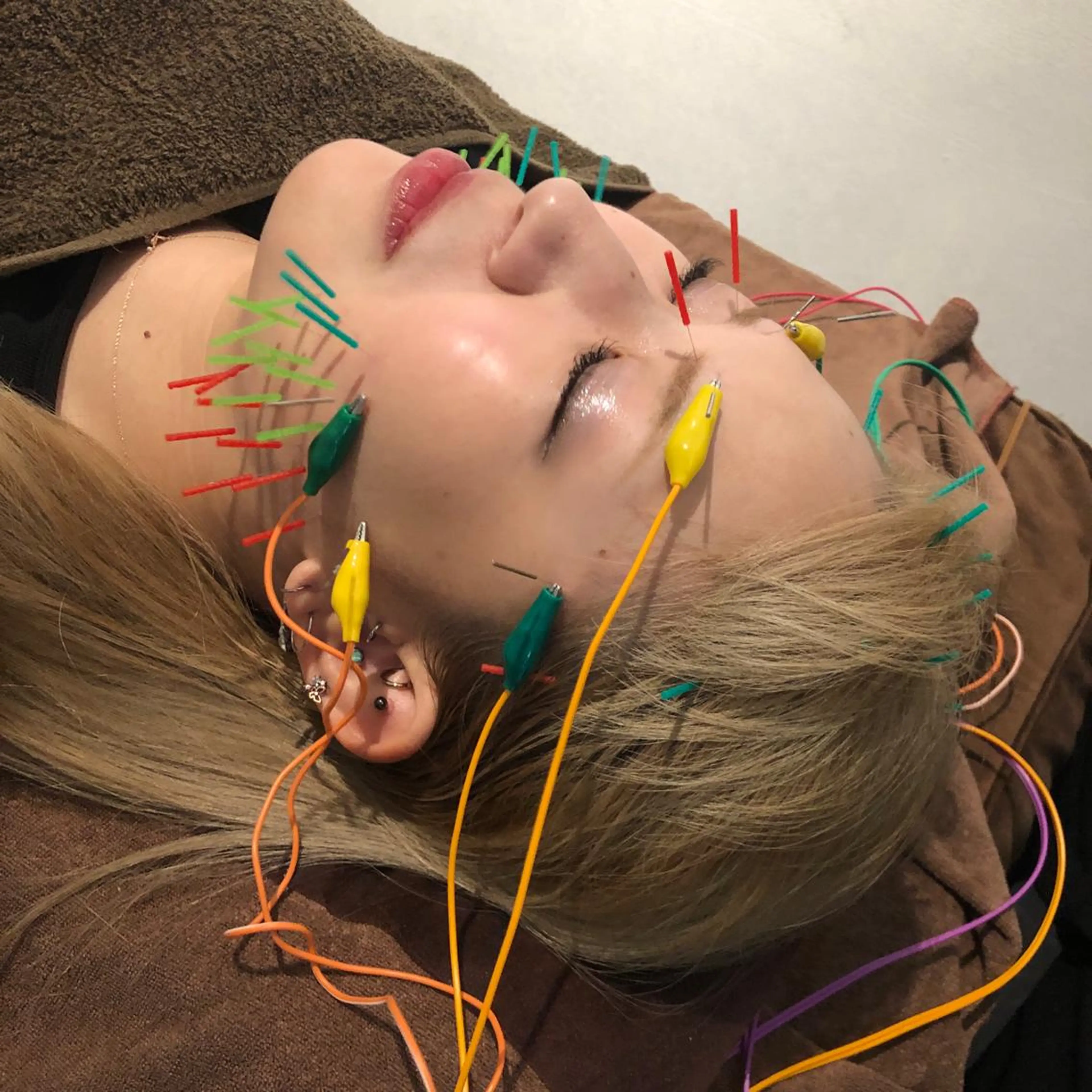 その他 美容鍼灸整体サロンBeauJu所属・小顔矯/美容鍼/鍼灸 BeauJuのその他イメージ