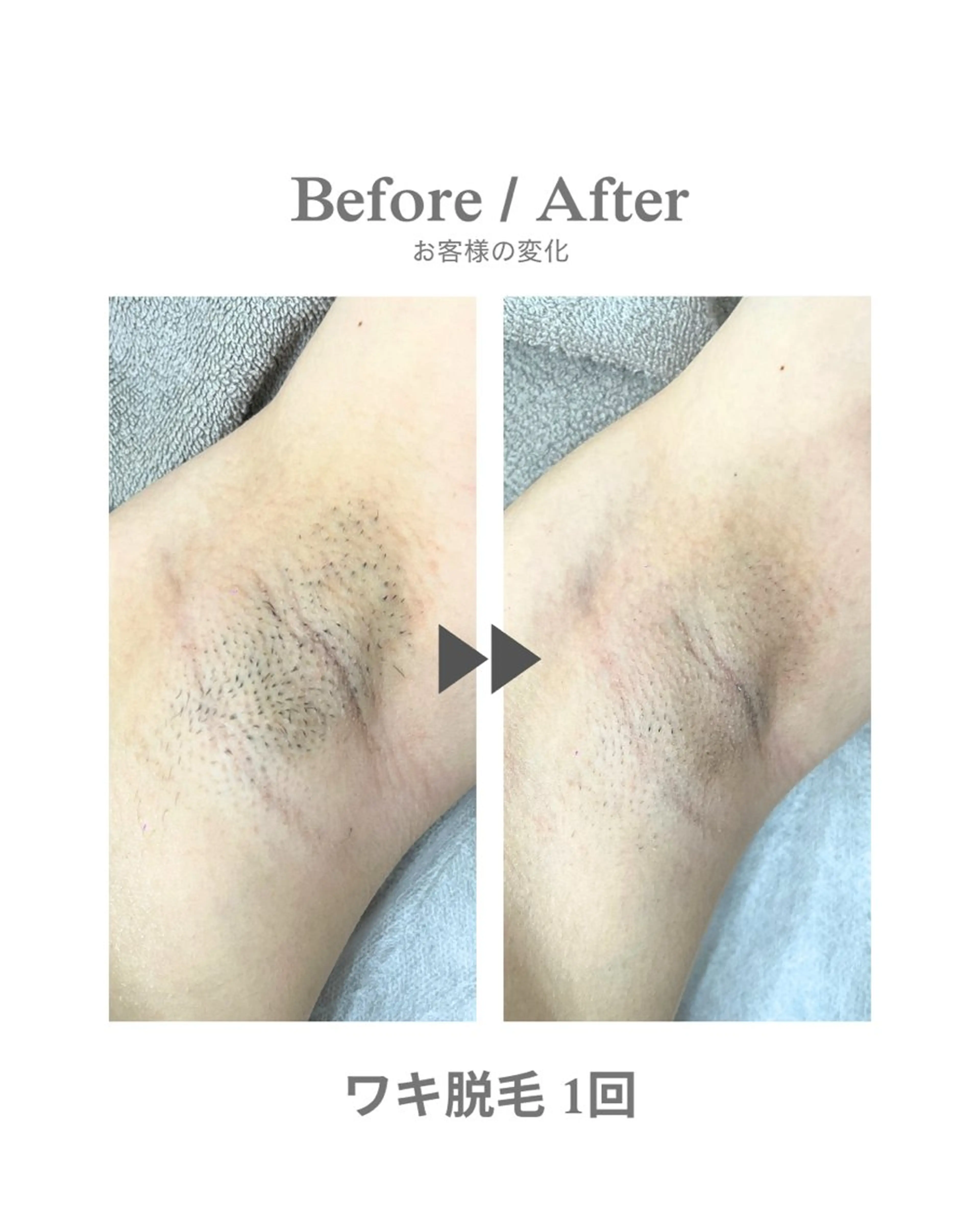 脱毛 エステサロンNarcis〜ナルシス〜所属・脱毛＆痩身エステ Narcisのエステ・リラクイメージ