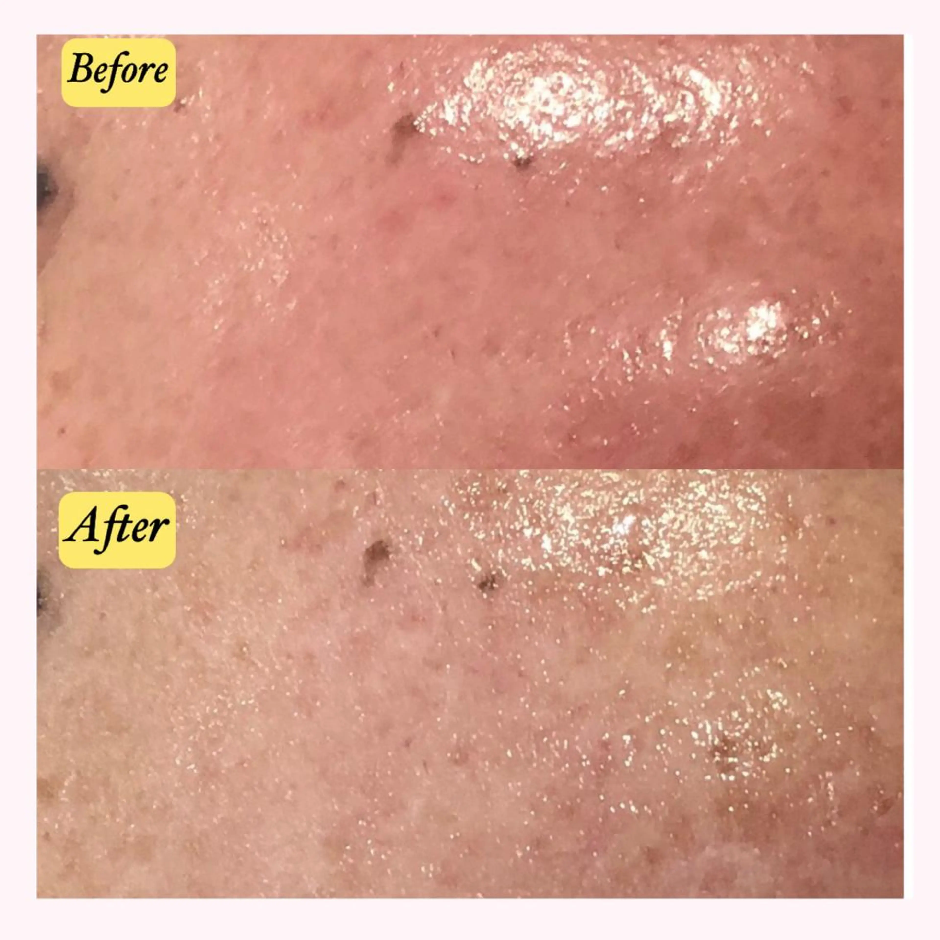 エステサロン　Sブランペタル所属・三沢市エステサロン Sブランペタルのエステ・リラクイメージ