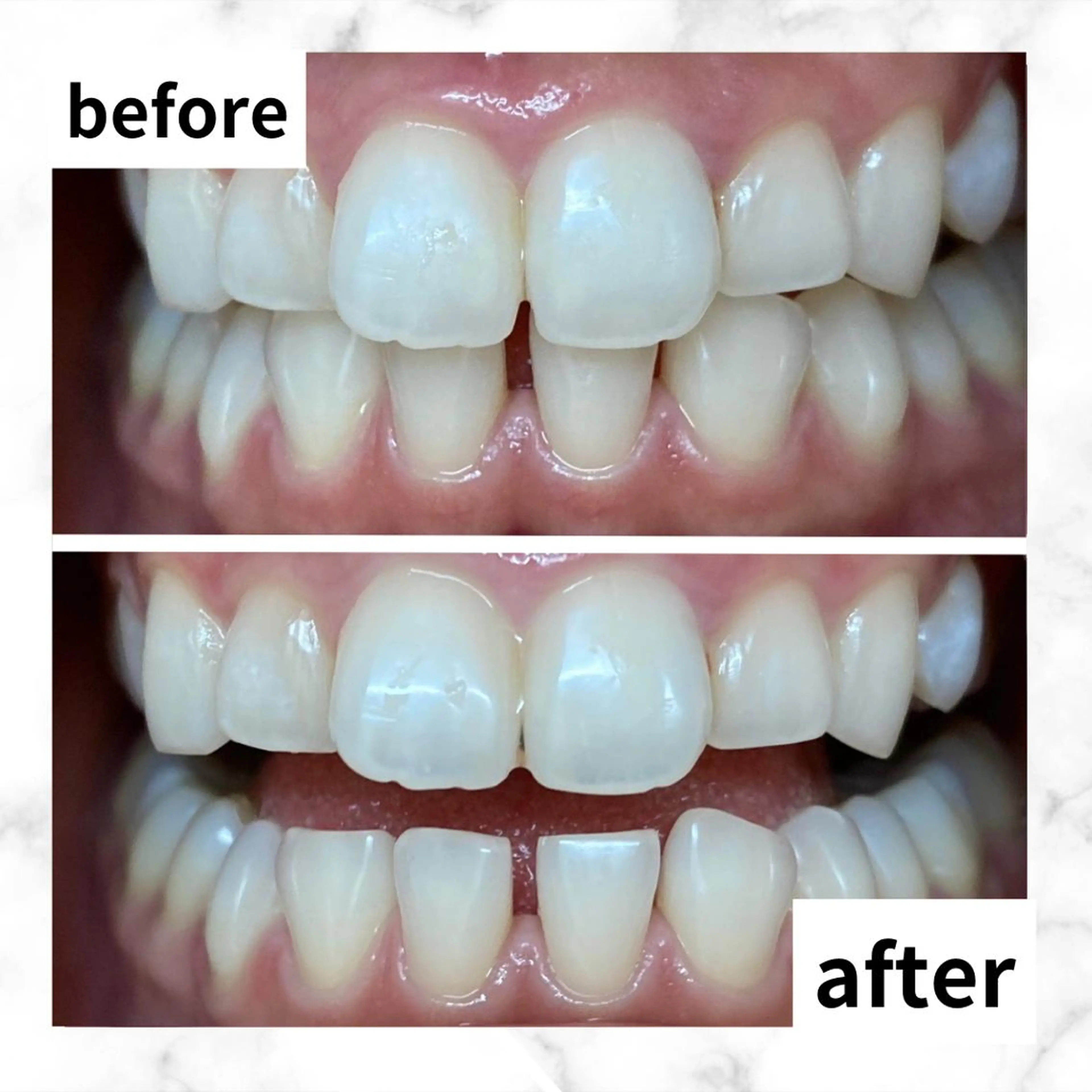 LBSホワイトニング 🌐渋谷店 河内のエステ・リラクイメージ