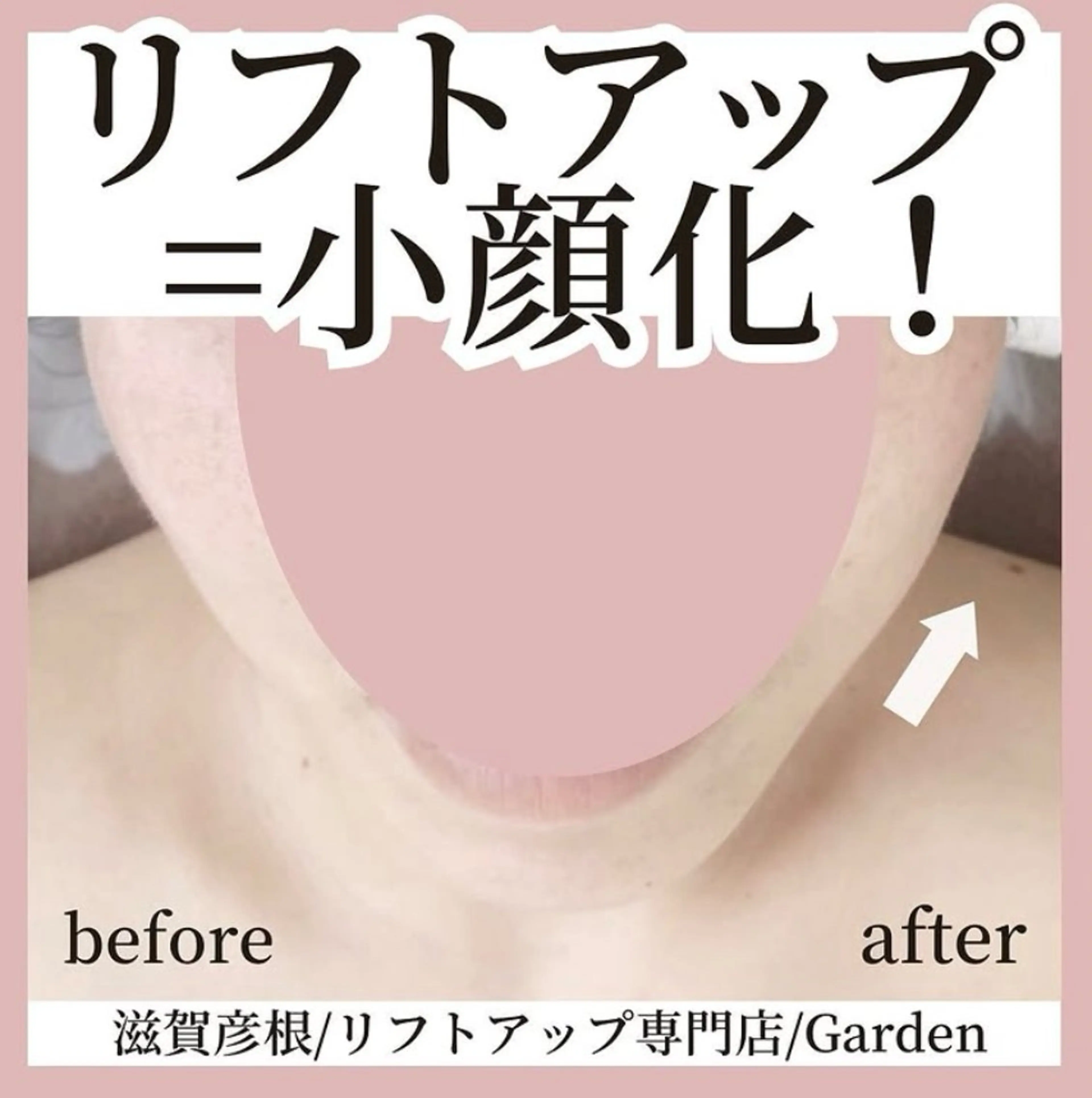 リフトアップ専門店 Gardenこやまのエステ・リラクイメージ