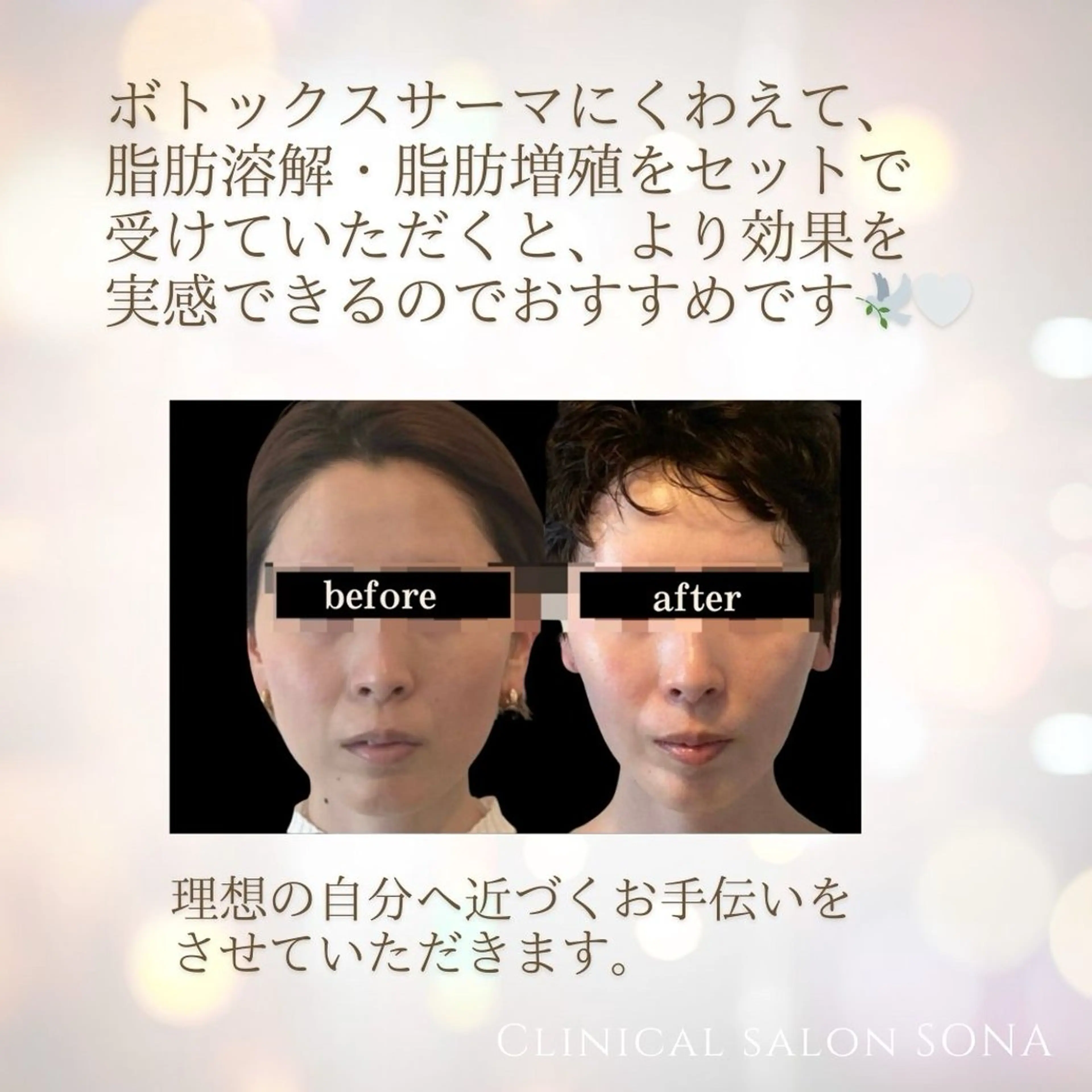 エステ 小顔/たるみ/黒ずみ除去専門サロン/SONA 大和西大寺店所属・【小顔専門看護師 サロンSONA】のエステ・リラクイメージ