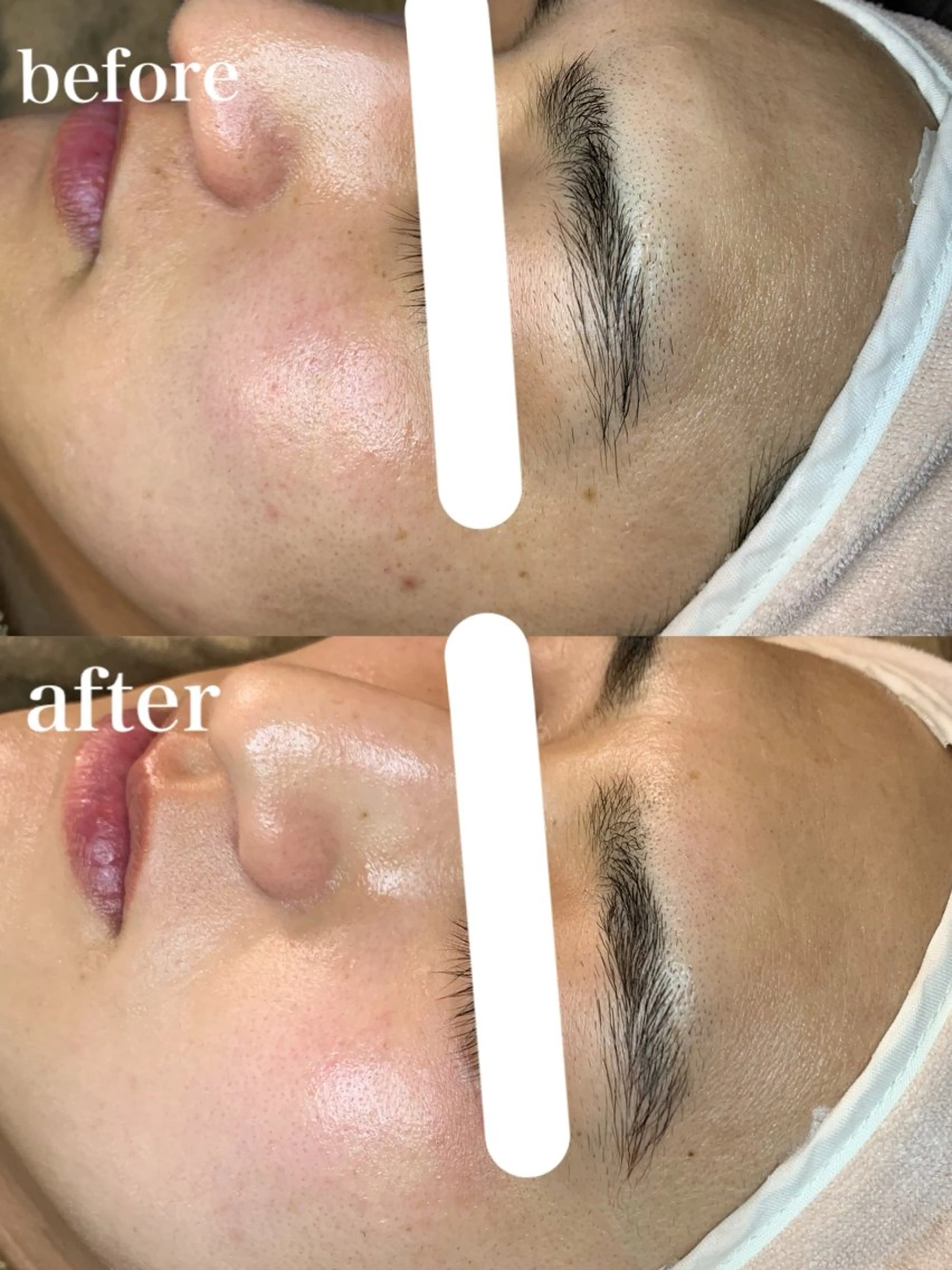 【都度払い専門】エステサロンARTI,天神大名店所属・【都度払い専門店】 エステサロARTI,のエステ・リラクイメージ