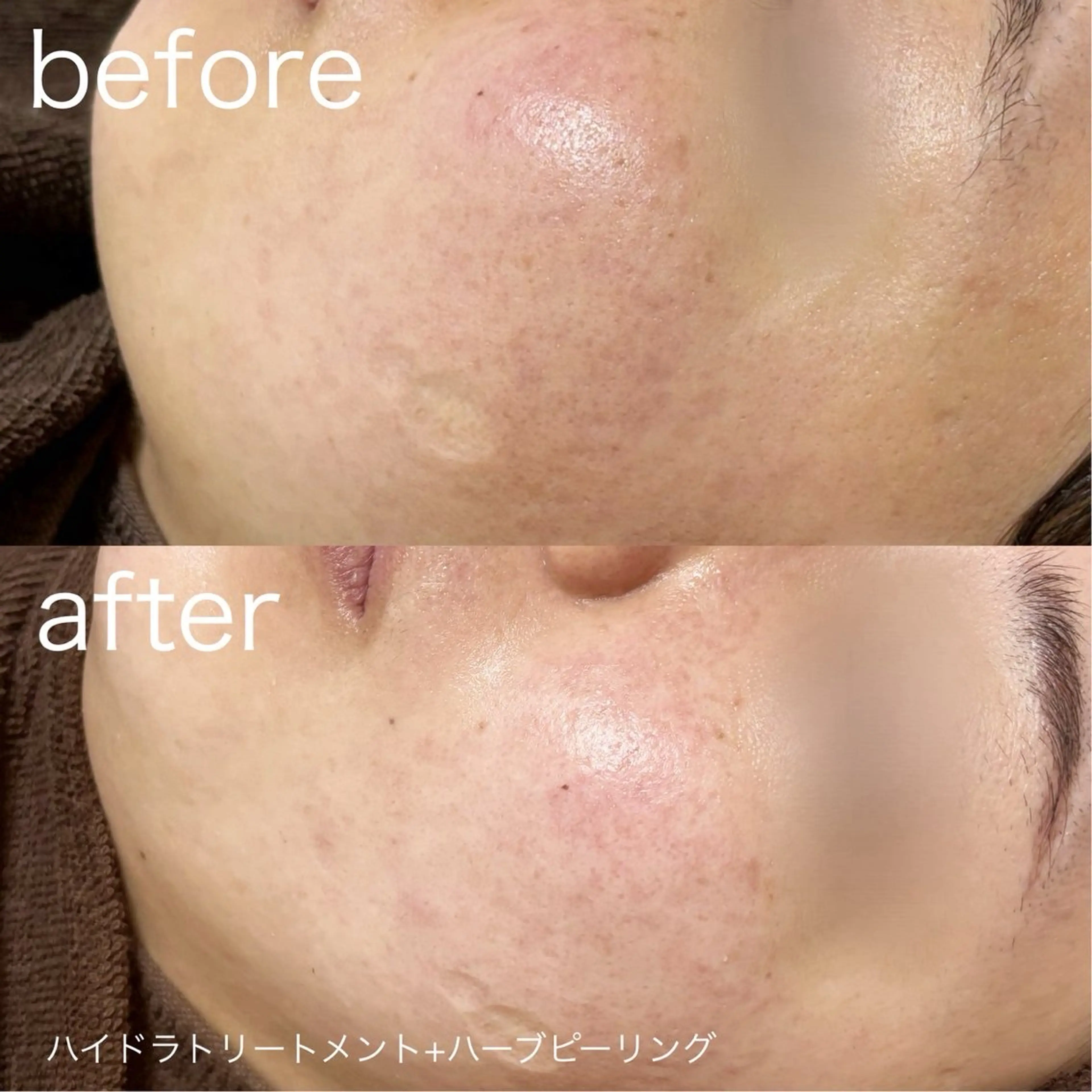 その他 lulularico Yuのエステ・リラクイメージ