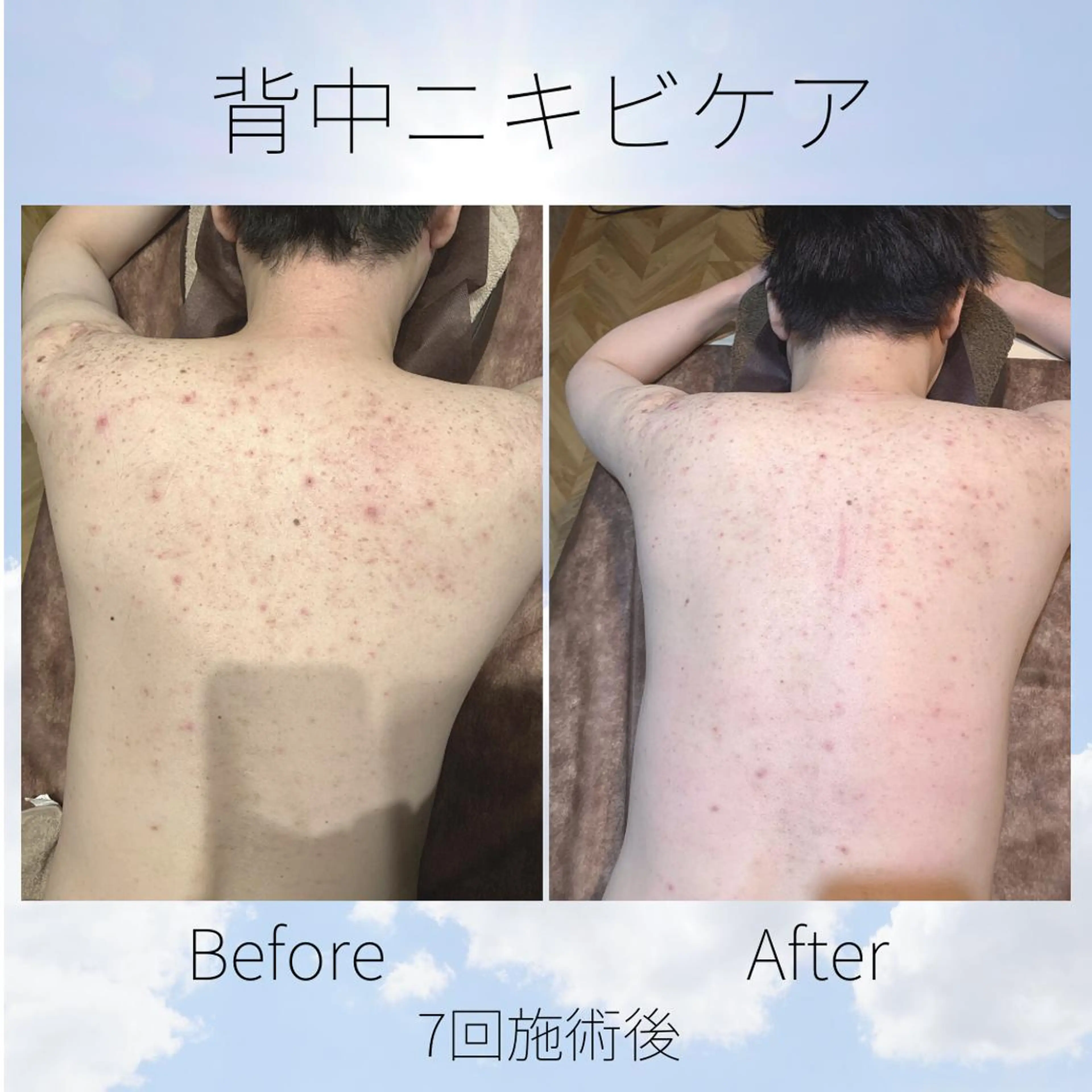 メンズ キッズ 男女同額完全個室脱毛 LEPIA内田のエステ・リラクイメージ