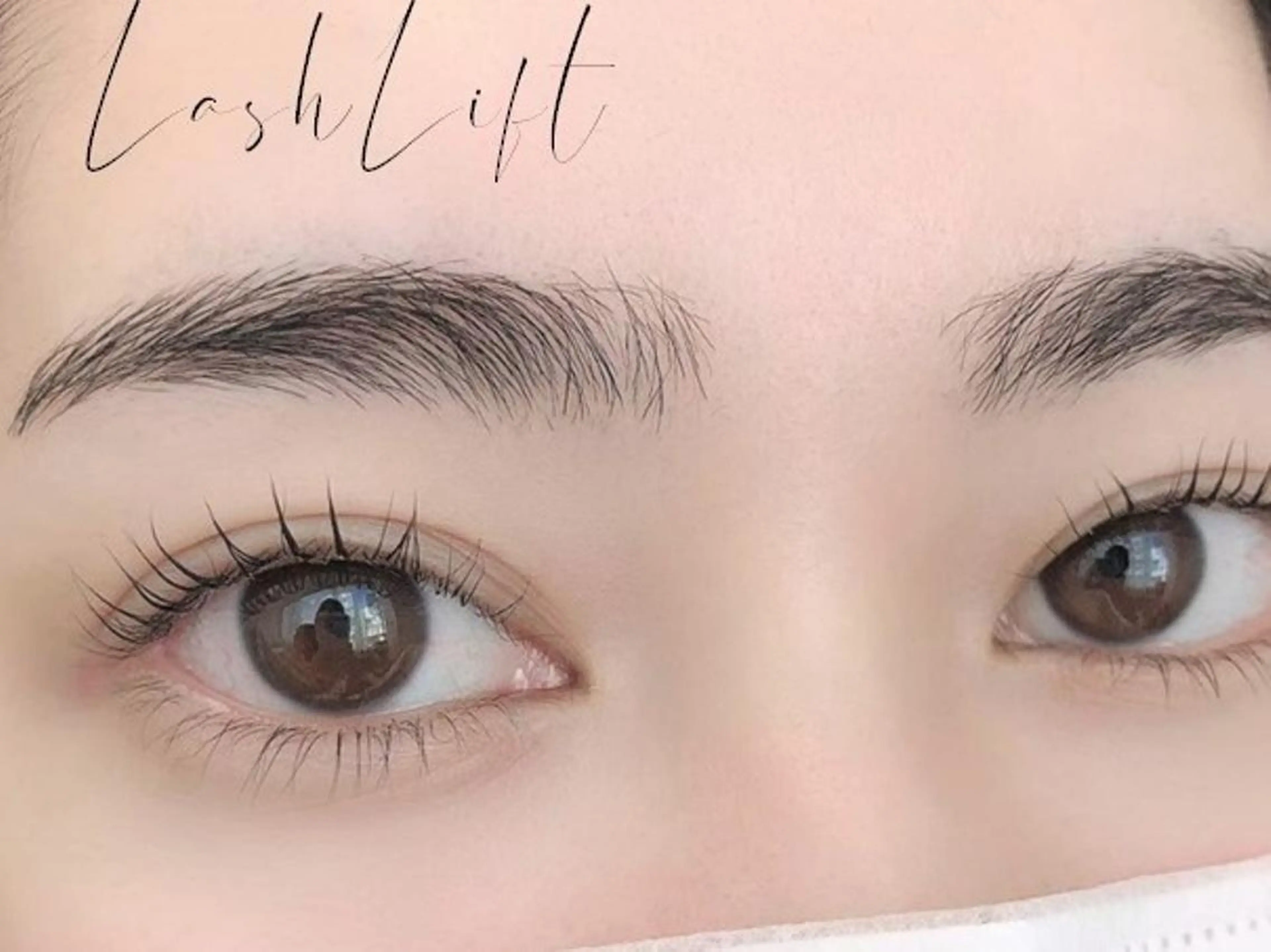 中顔面短縮☆下エクの写真