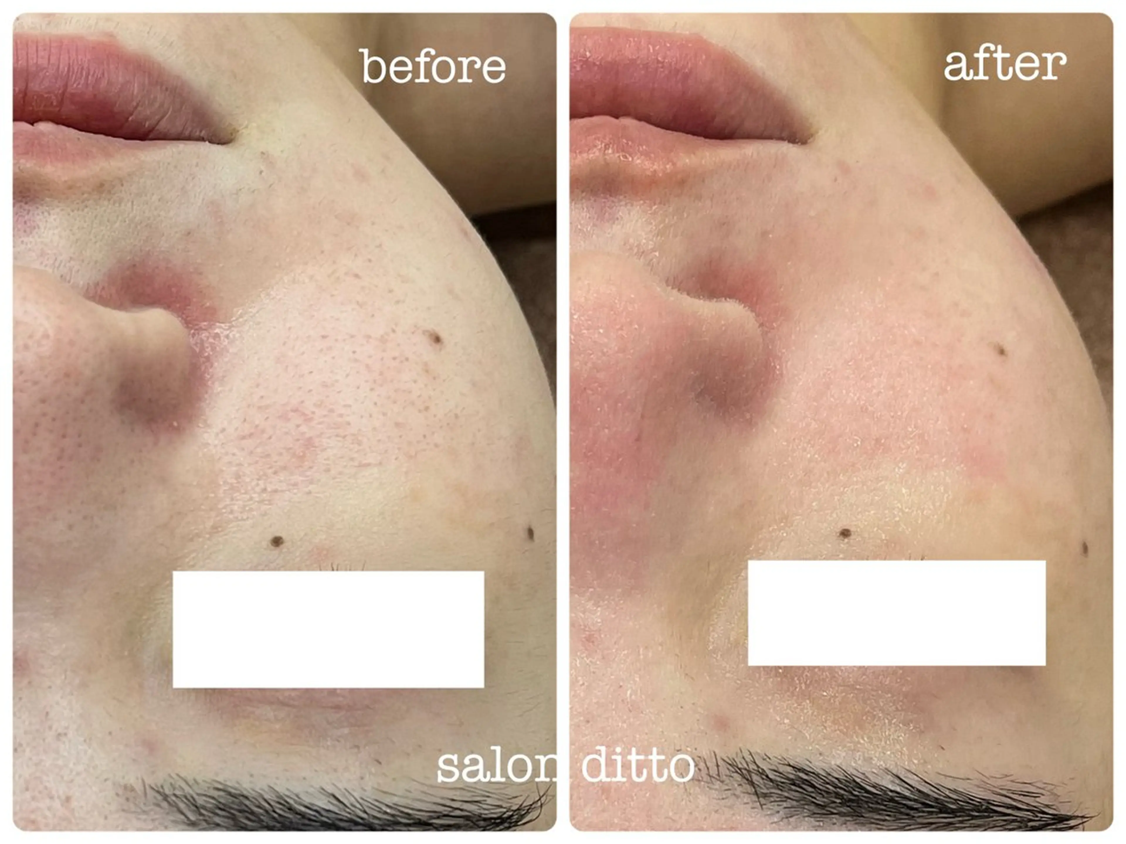 エステ リラク salon ditto所属・mio (小顔・ヘッドスパ)のエステ・リラクイメージ