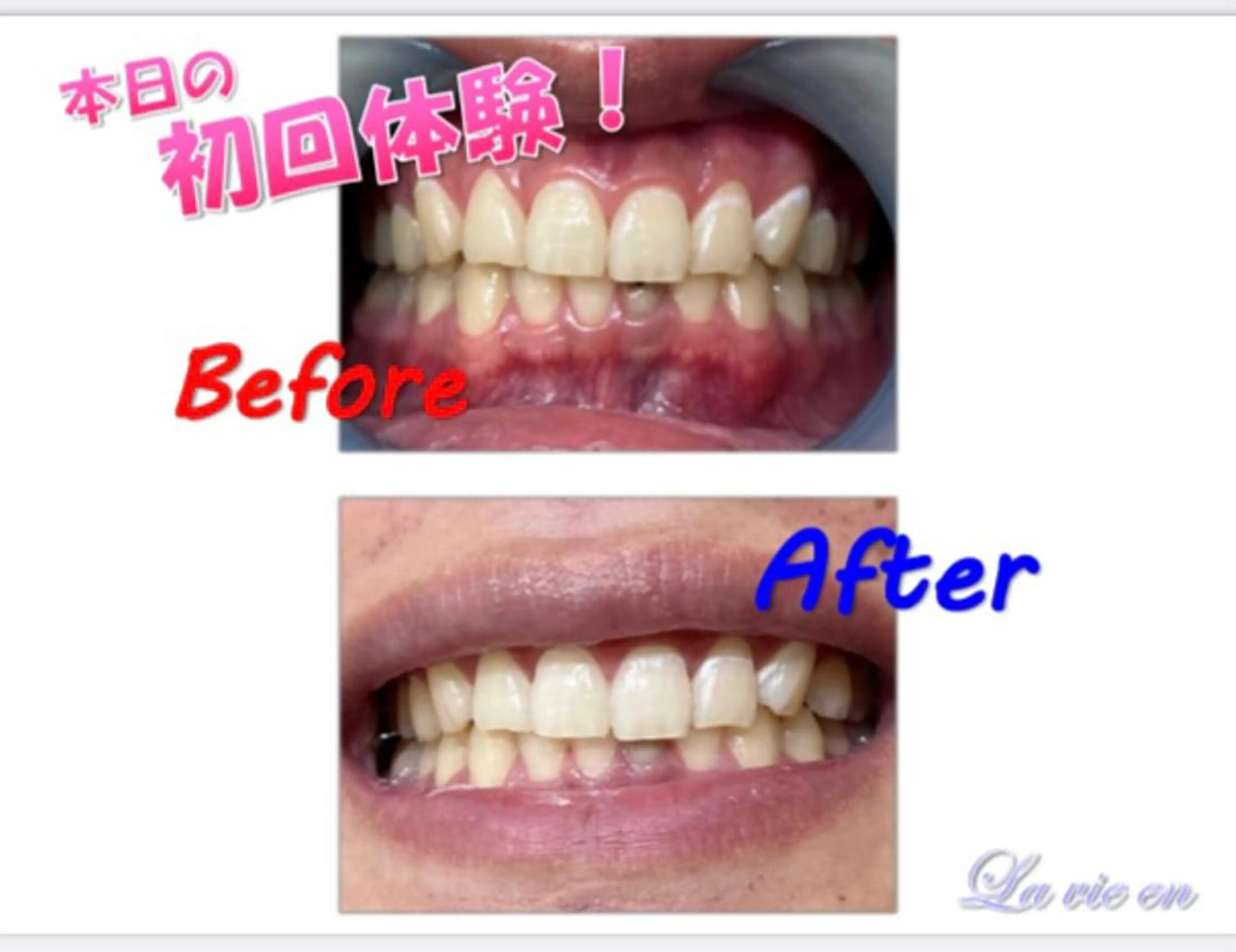 その他 セルフホワイトニングサロン　ラヴィアン所属・ホワイトニングサロン La vie enのその他イメージ