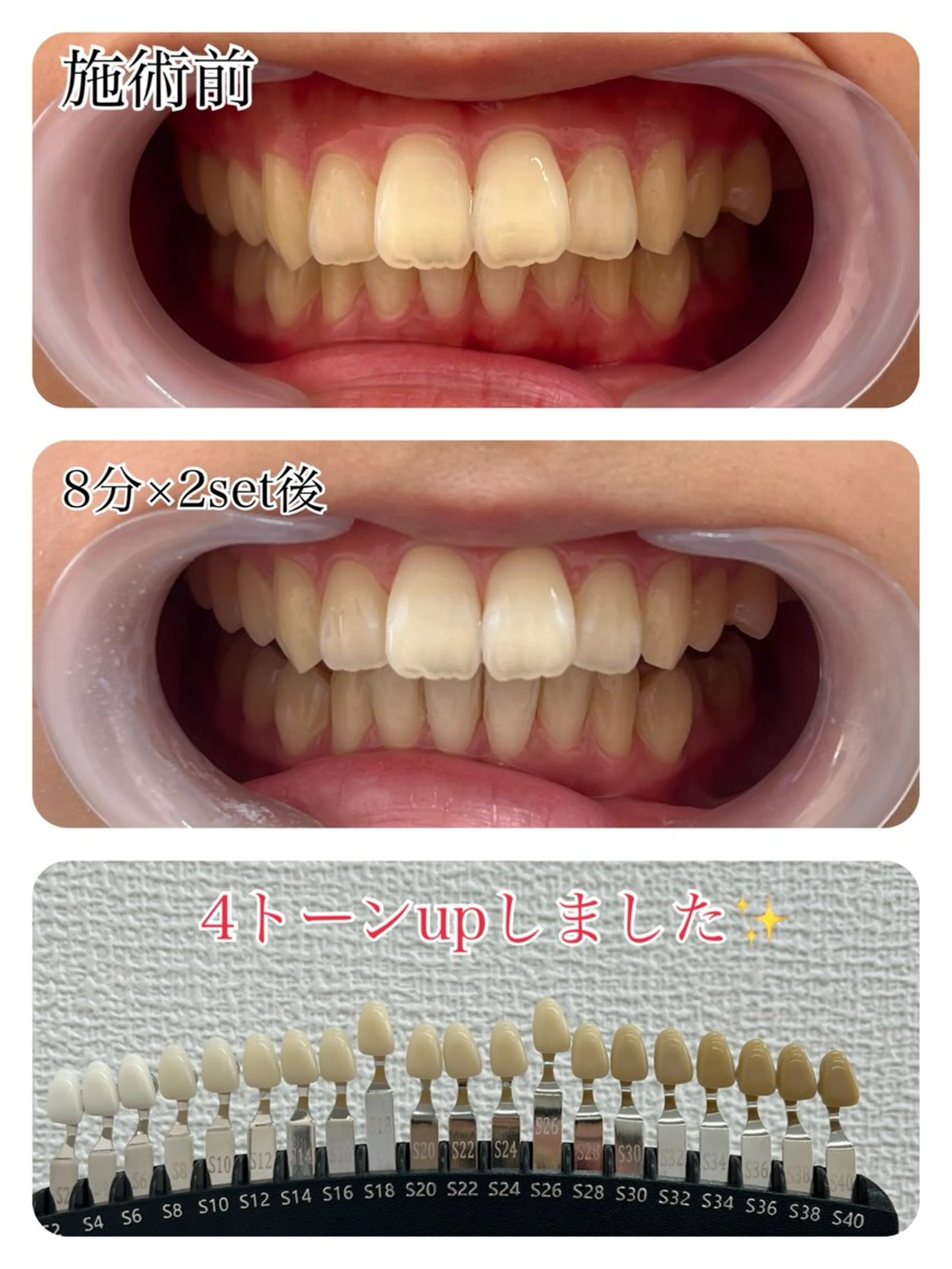 その他 セルフホワイトニング 池袋　プラネットのその他イメージ