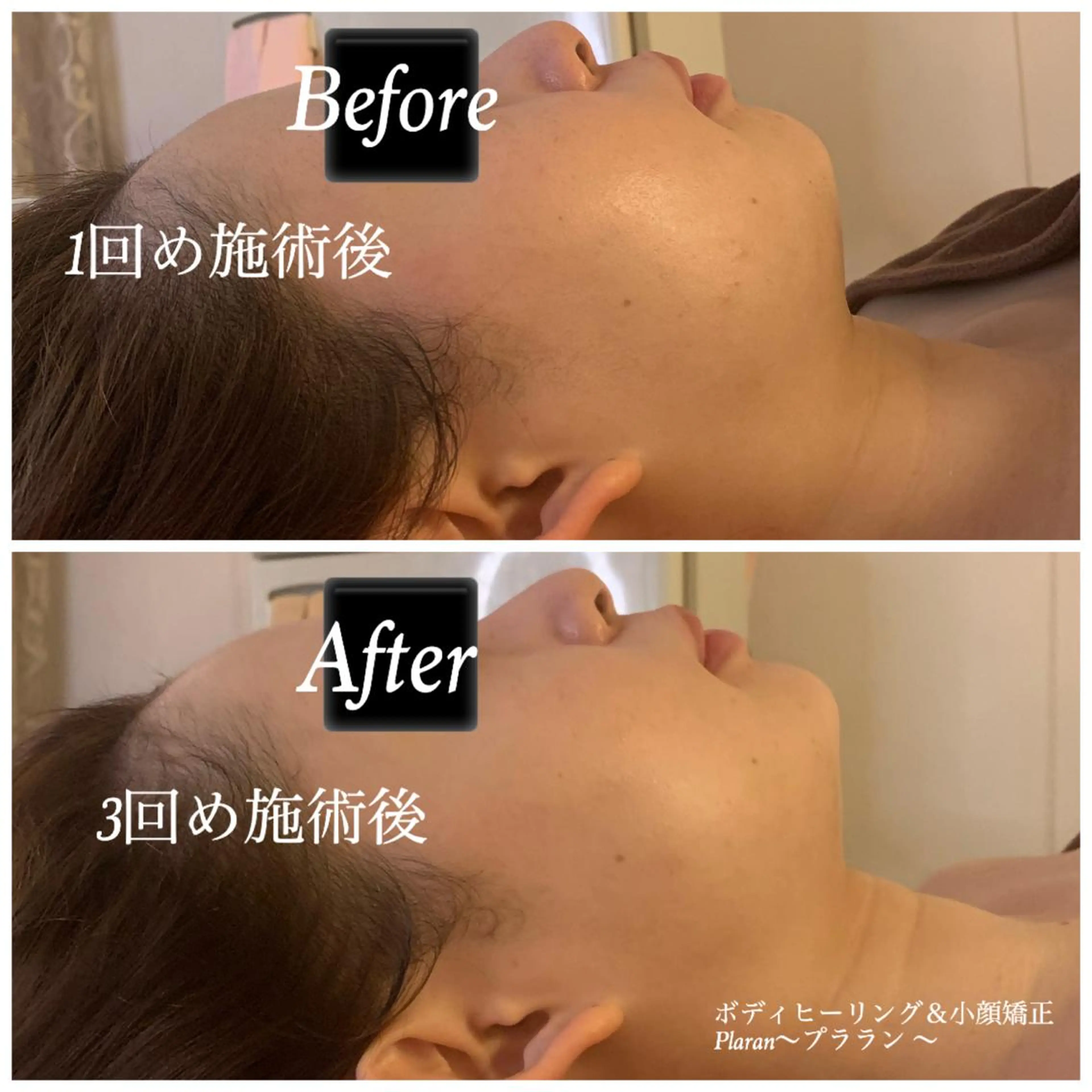 Plaran 〜プララン 〜のその他イメージ