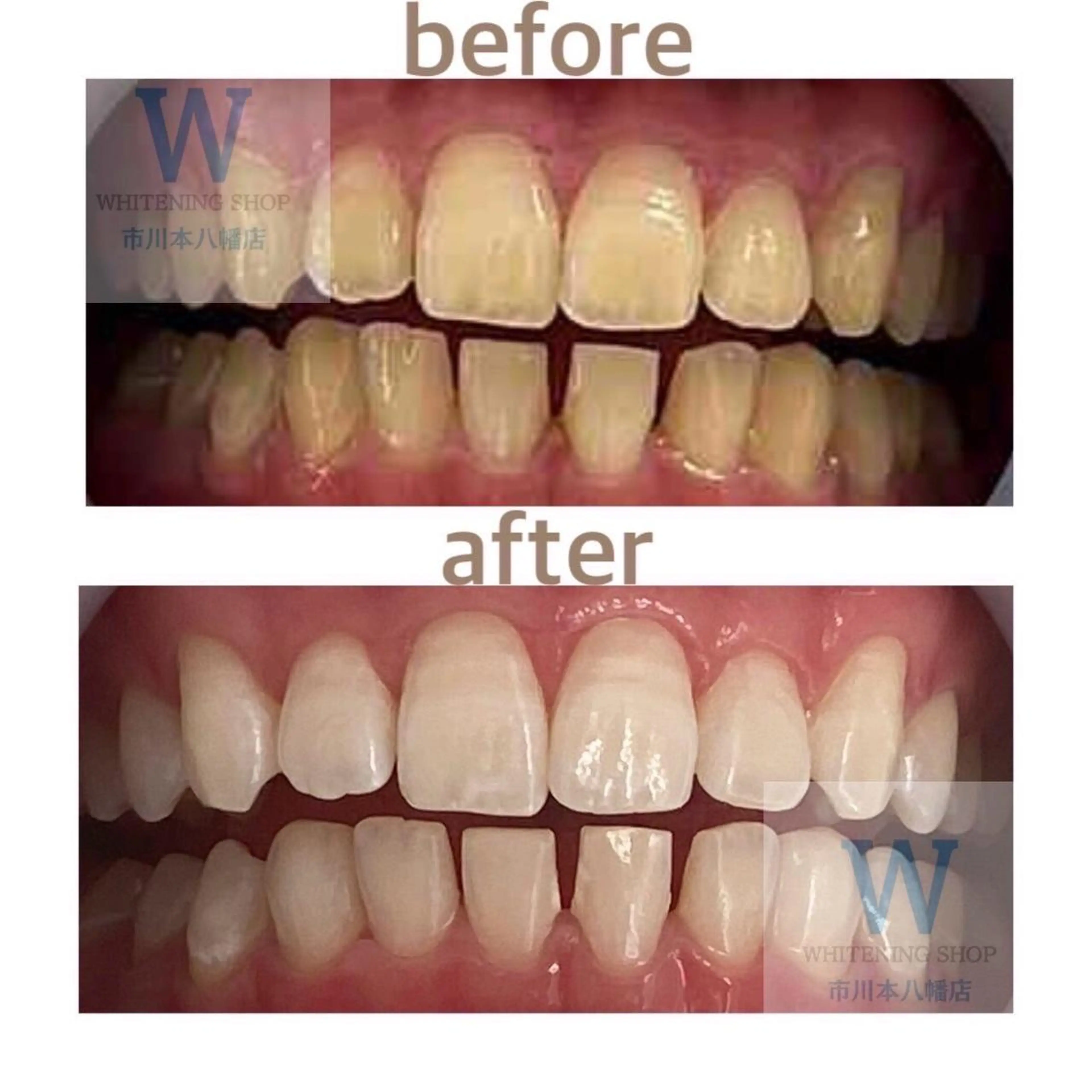 ホワイトニング ショップ本八幡店のエステ・リラクイメージ