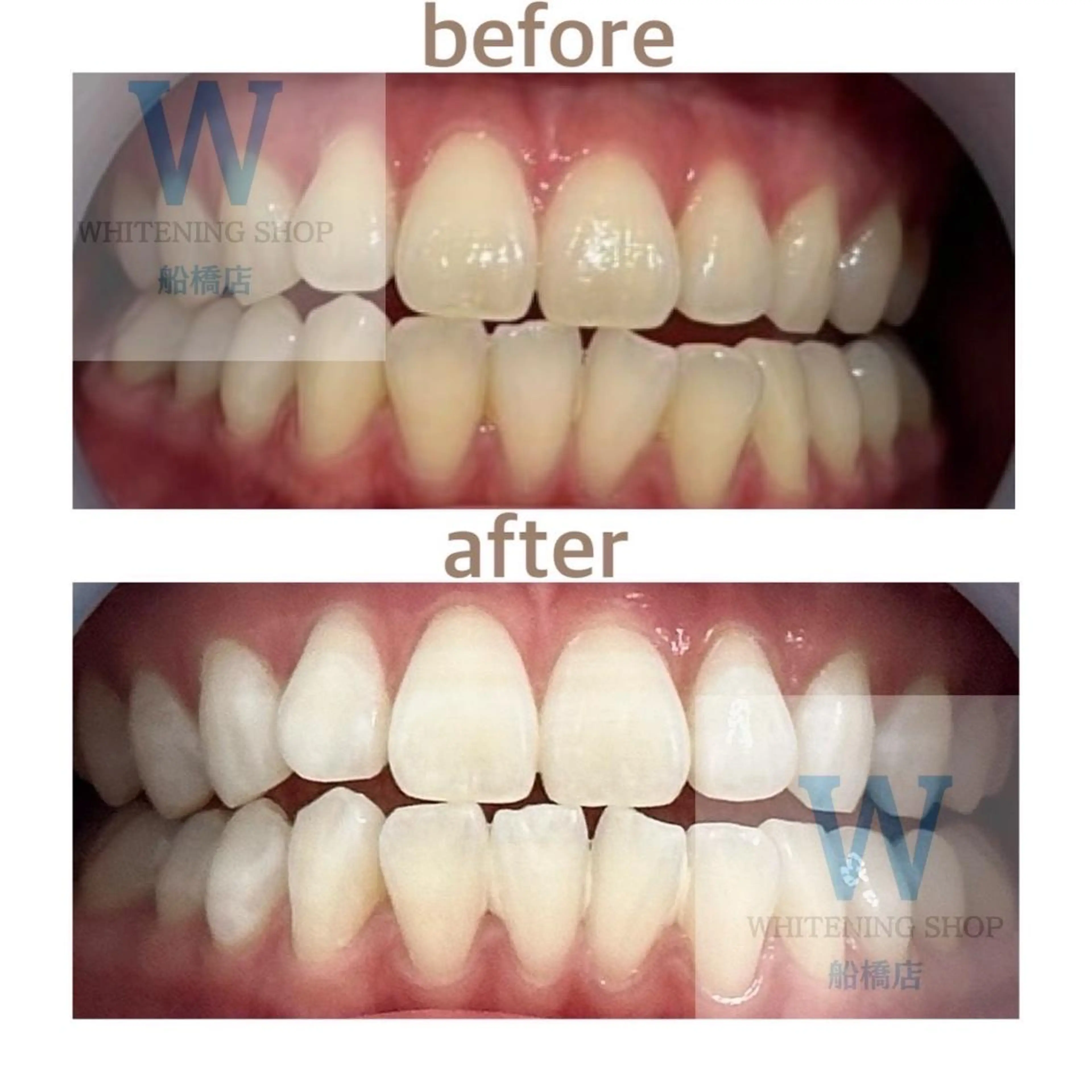 エステ リラク ホワイトニング ショップ船橋２号店のエステ・リラクイメージ