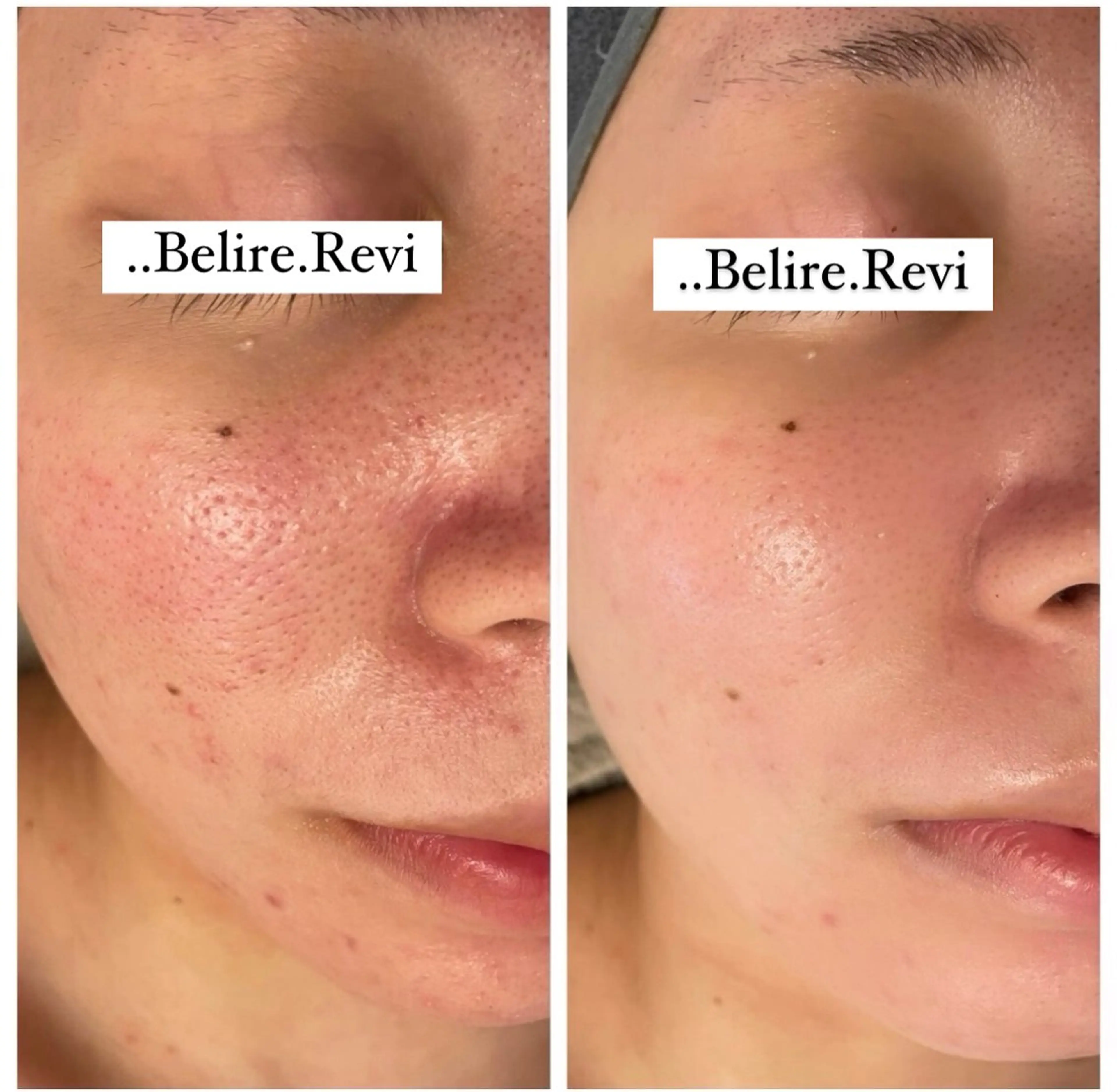 ..Belire.Revi所属・ベリールルヴィ ベリールルヴィのエステ・リラクイメージ