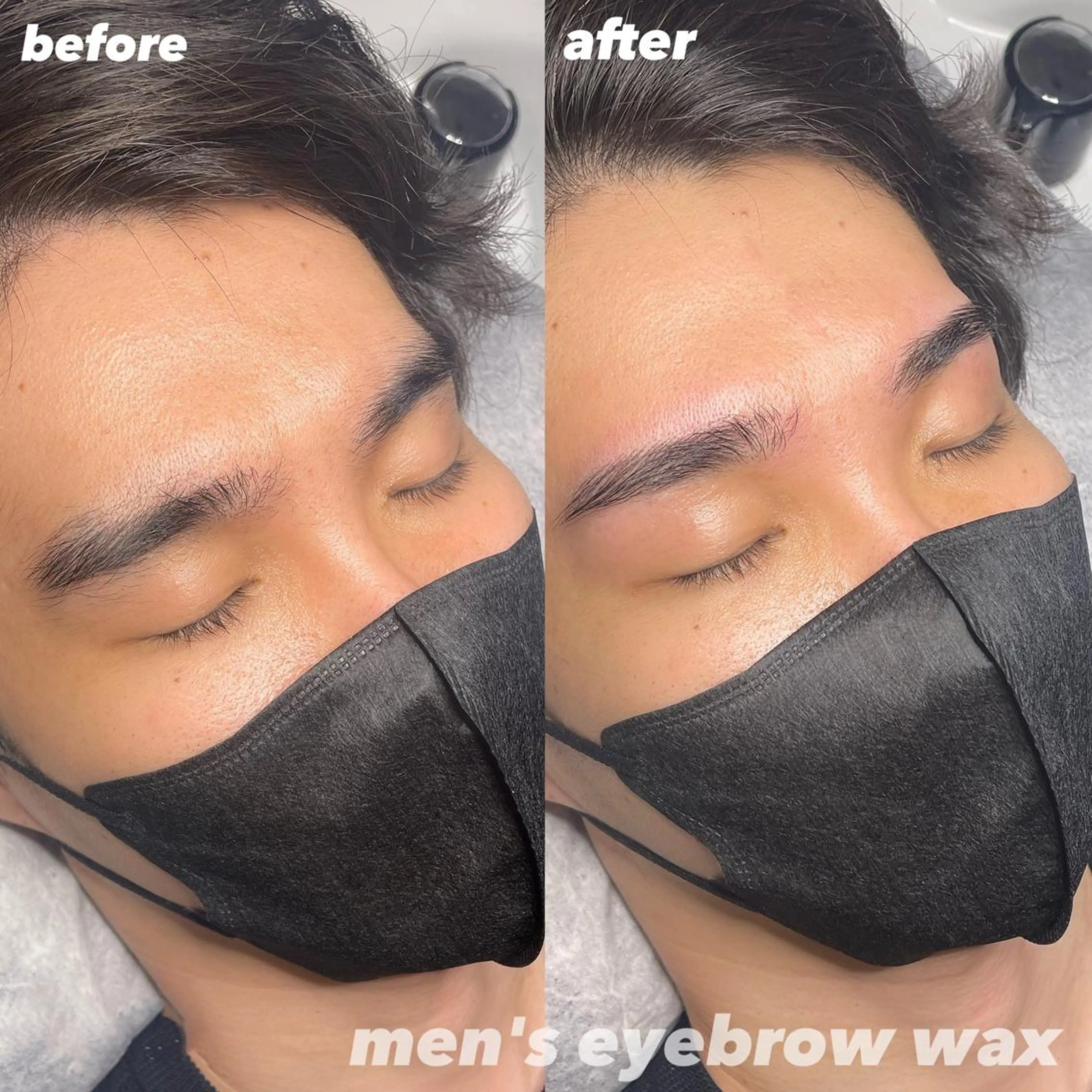 【メンズ・ミニモ限定価格】眉周りワックス脱毛の写真