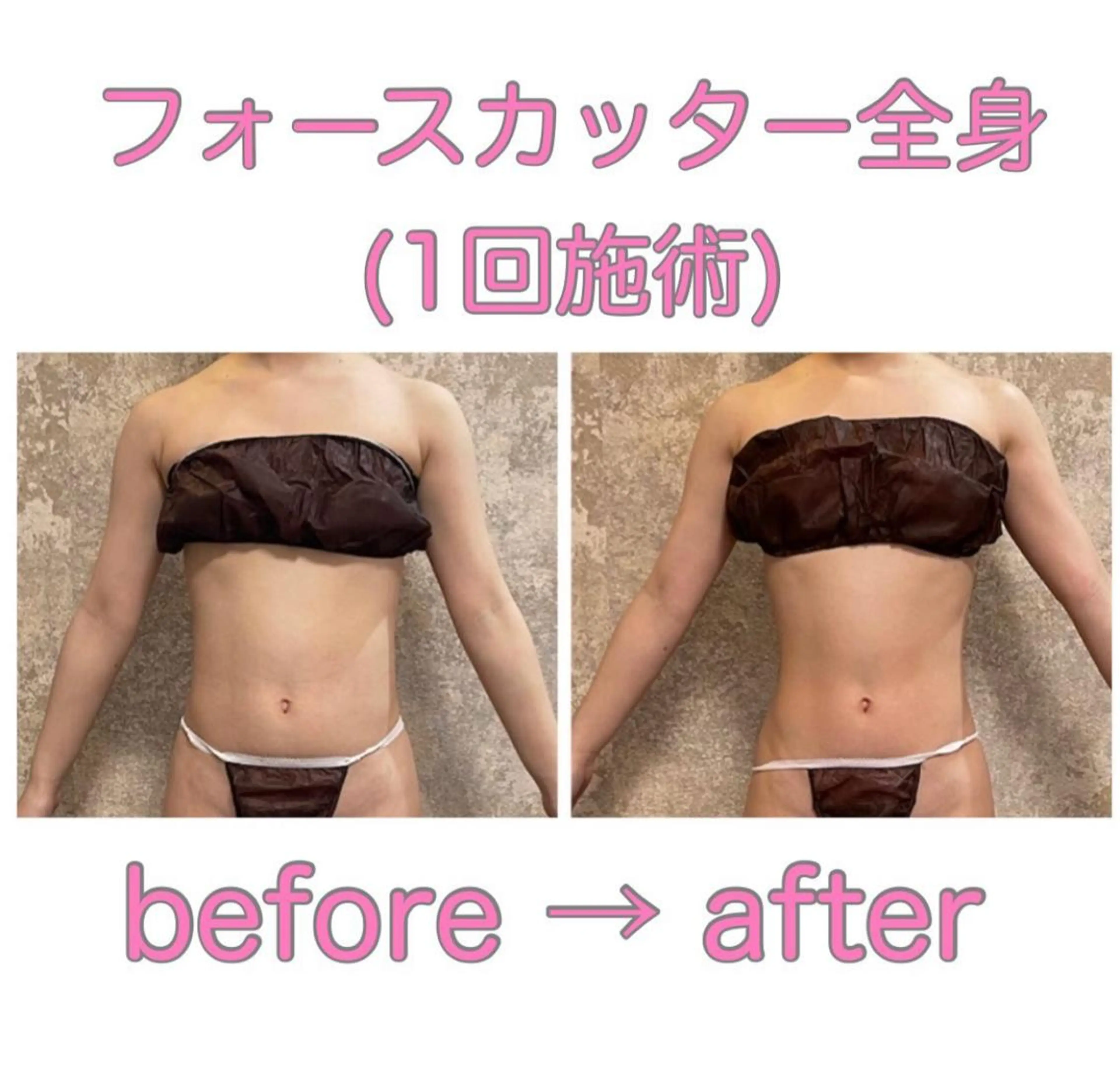 痩身/美肌/脱毛 MAX BEAUTYのエステ・リラクイメージ