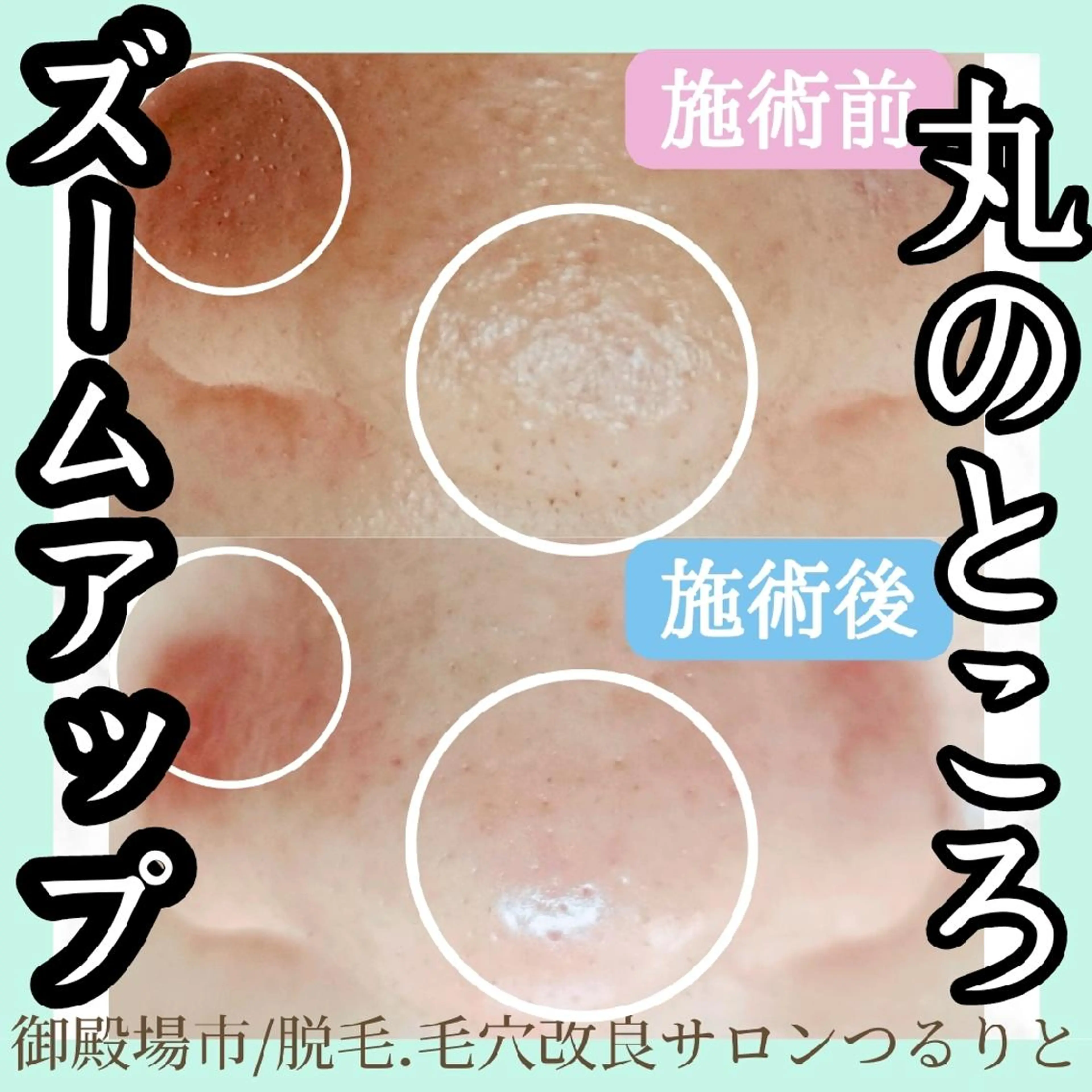 美肌脱毛サロン つるりと御殿場店所属・美肌脱毛サロン つるりとのその他イメージ