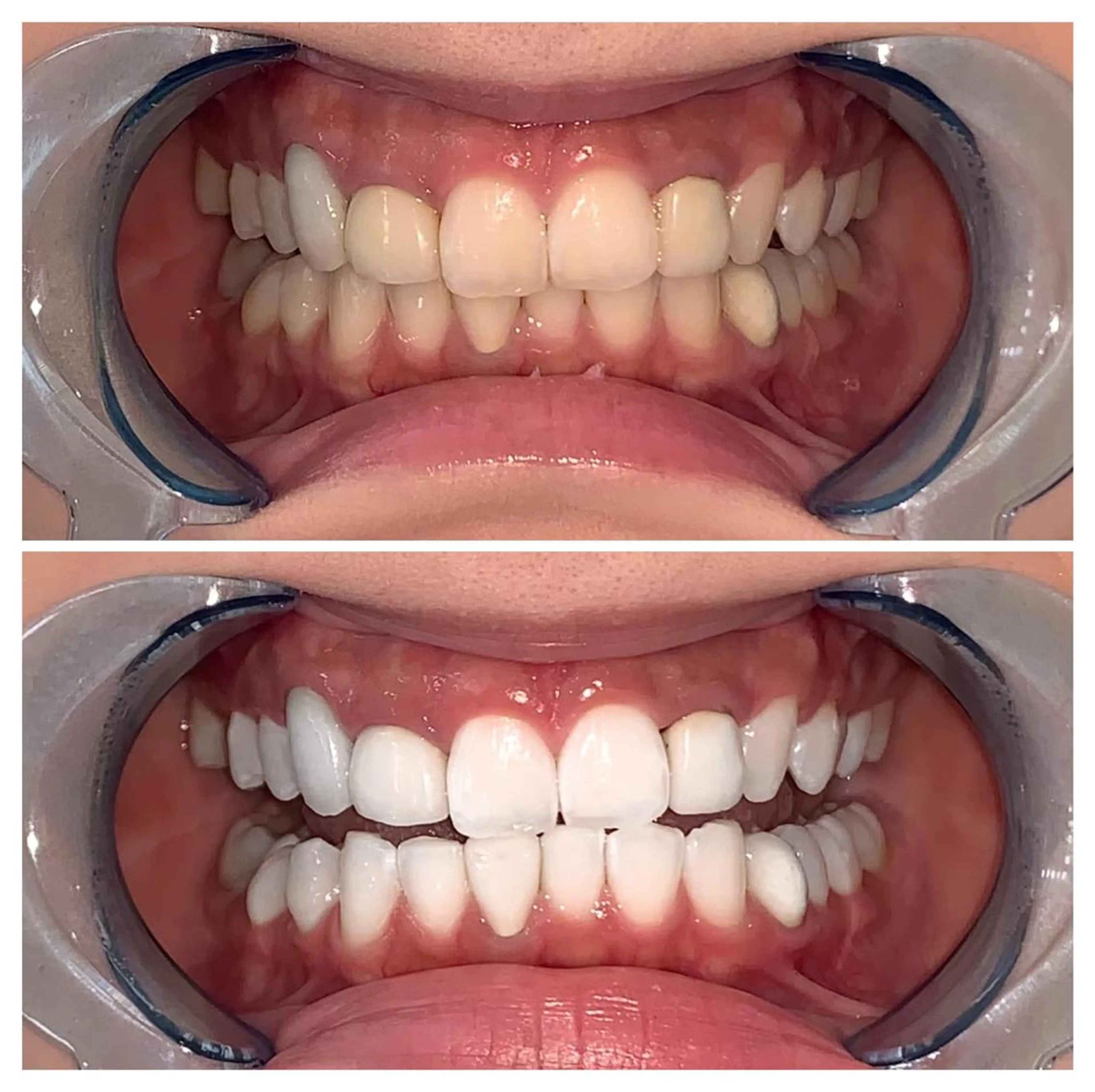 メンズ ライトビューティー 錦糸町店のエステ・リラクイメージ