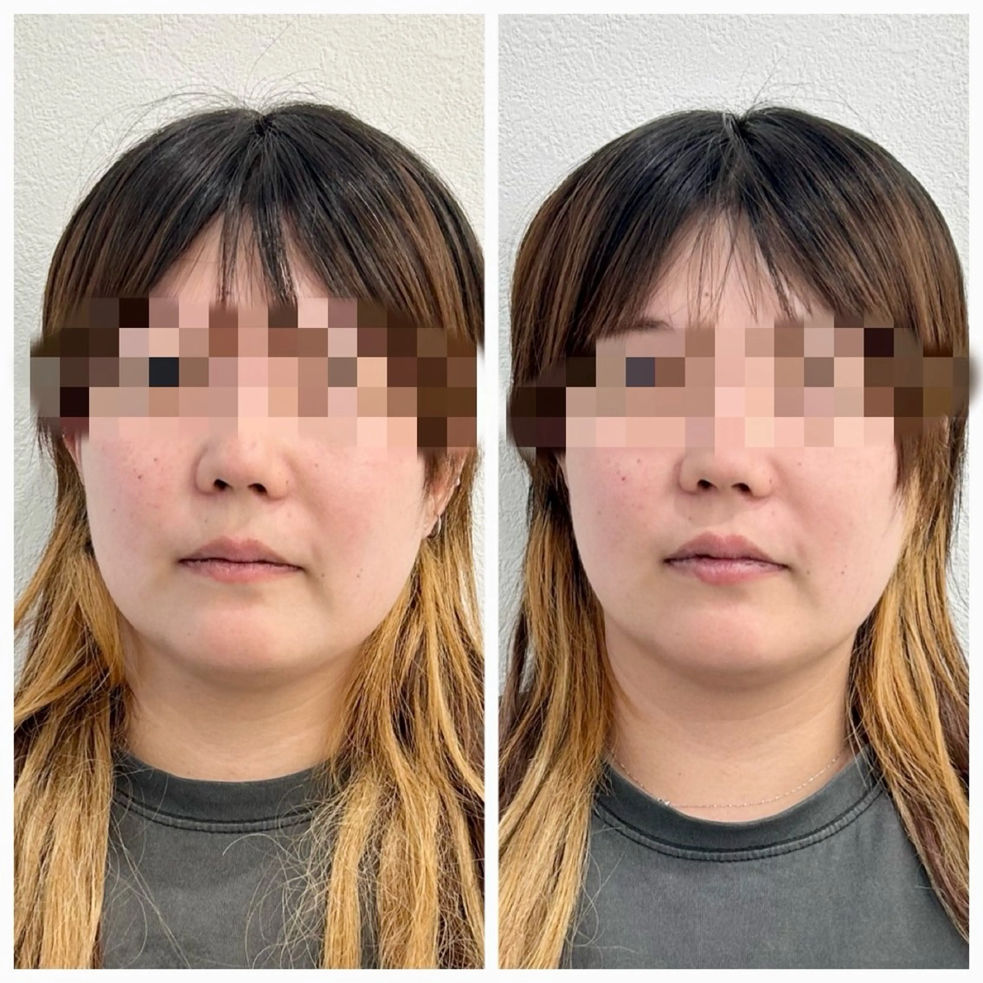 エステ リラク 鍼灸HARIKARA所属・辛島 昴のエステ・リラクイメージ