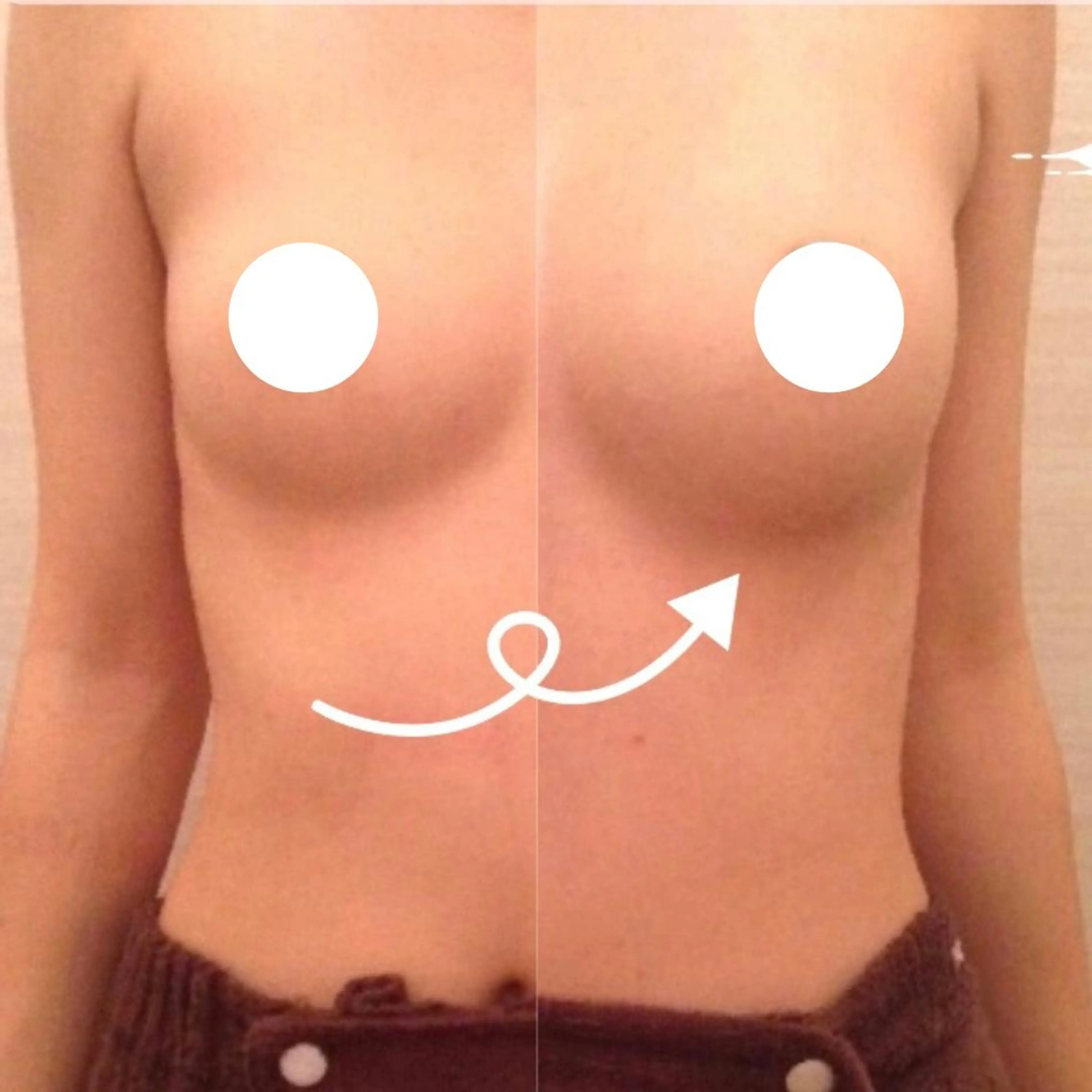 エステ バスト・脱毛・痩身 上島のエステ・リラクイメージ