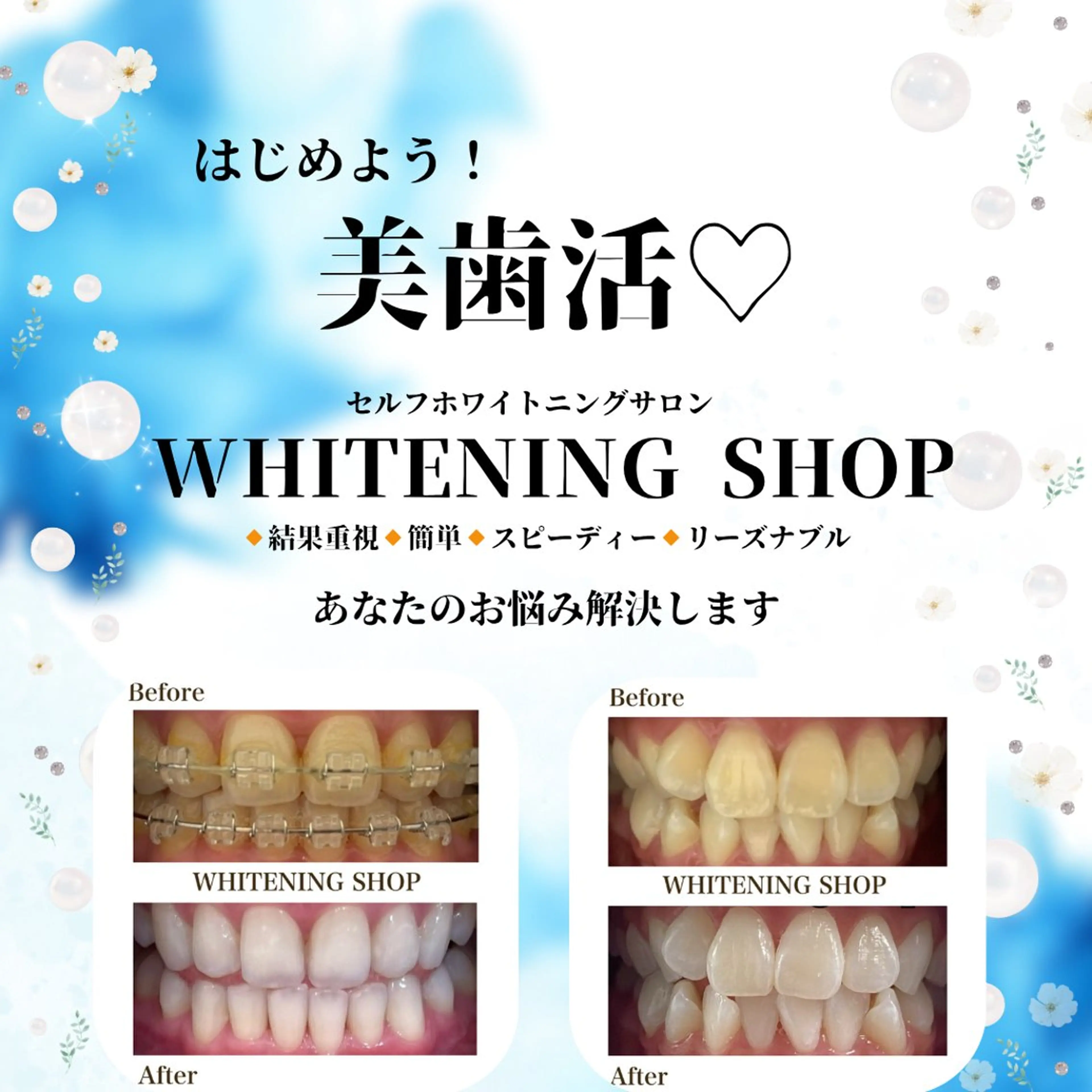 メンズ ホワイトニングショップ静岡葵区店所属・ホワイトニング ショップ葵区静岡駅店のその他イメージ