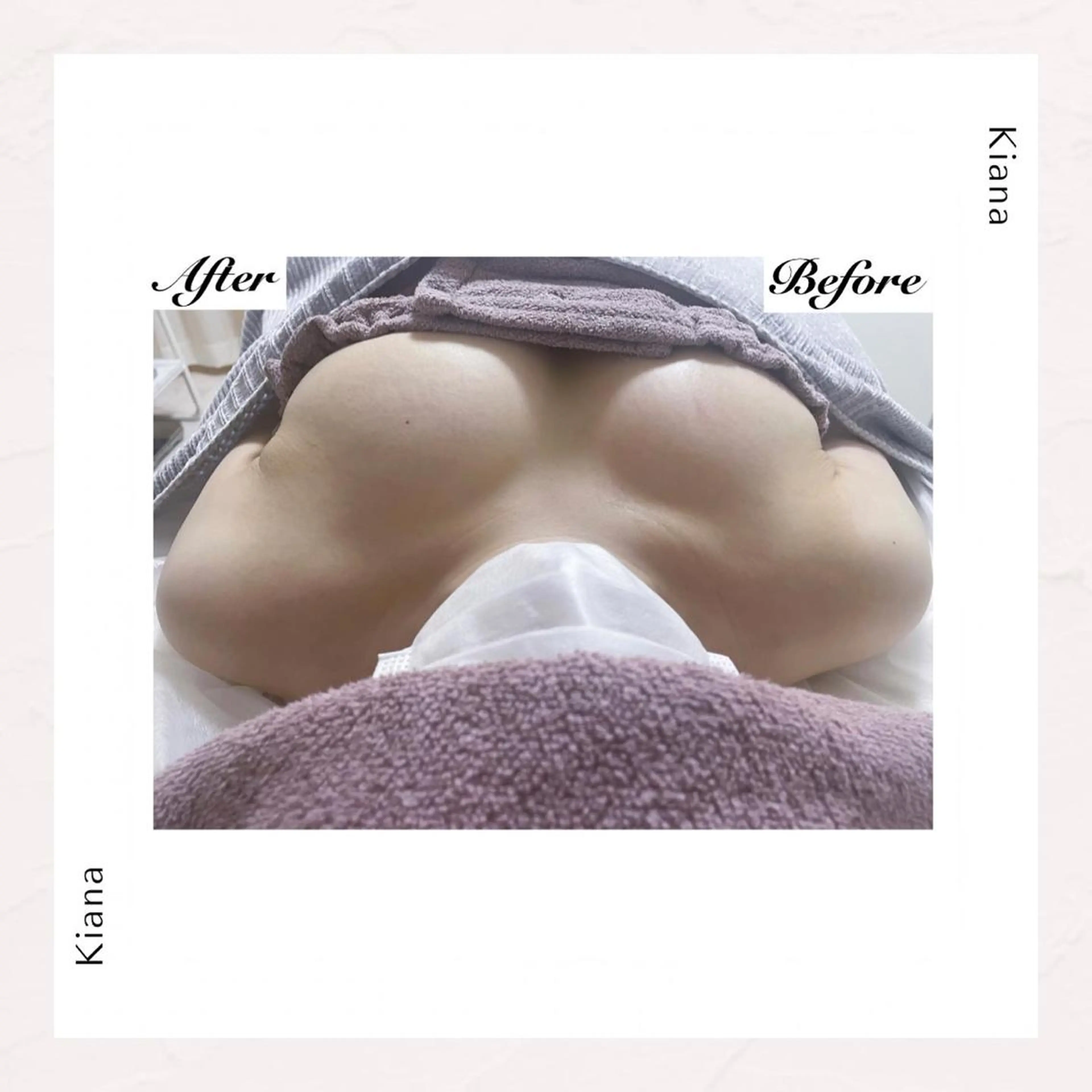 エステ リラク バスト専門Kiana 風のエステ・リラクイメージ