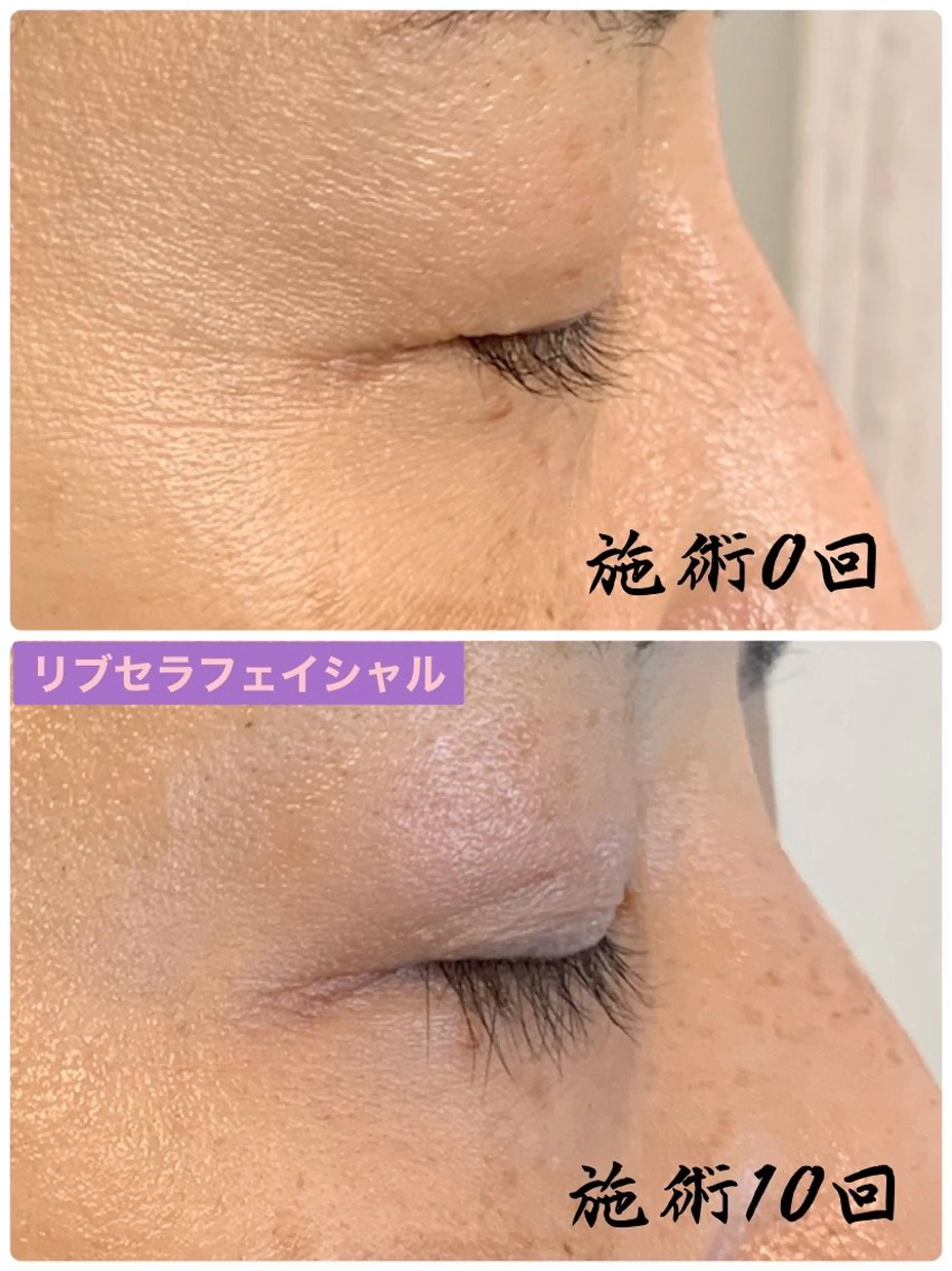 エステ Private Salon Prunelle所属・プライベートサロン プリュネルのエステ・リラクイメージ