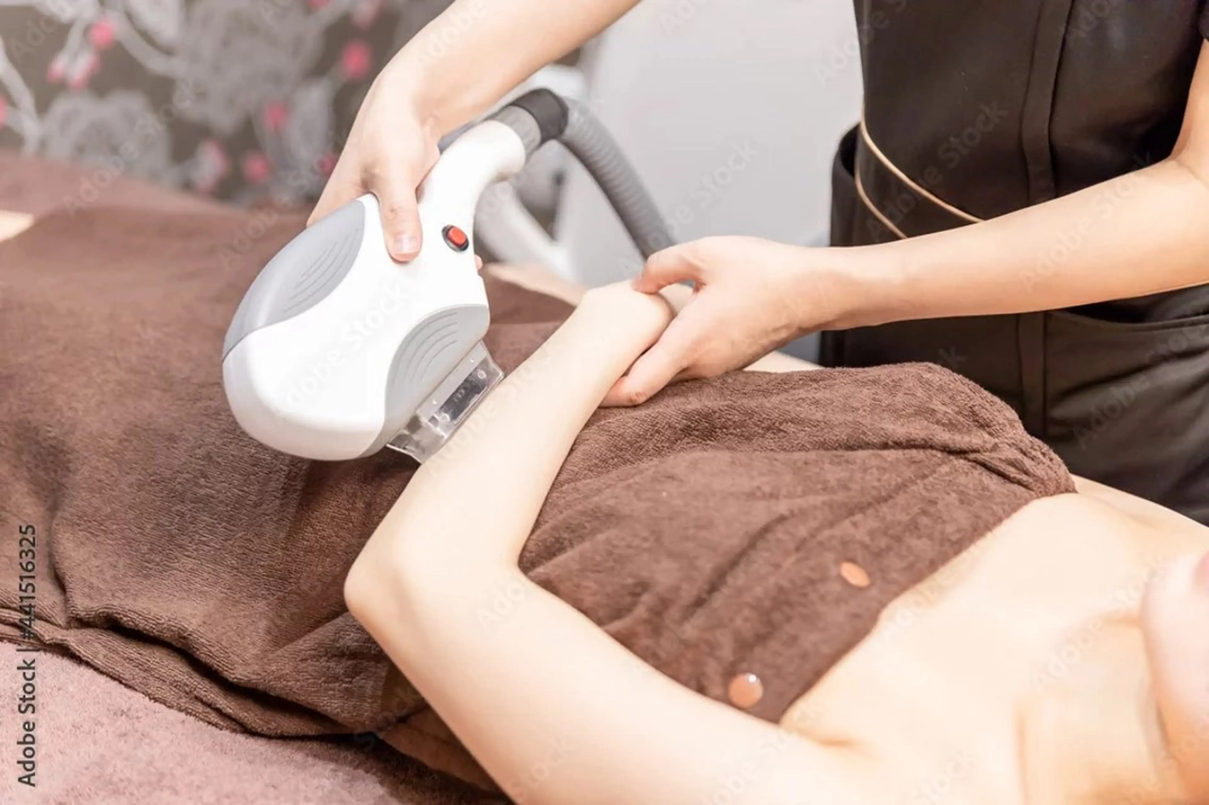 平日限定！新規全身脱毛の写真