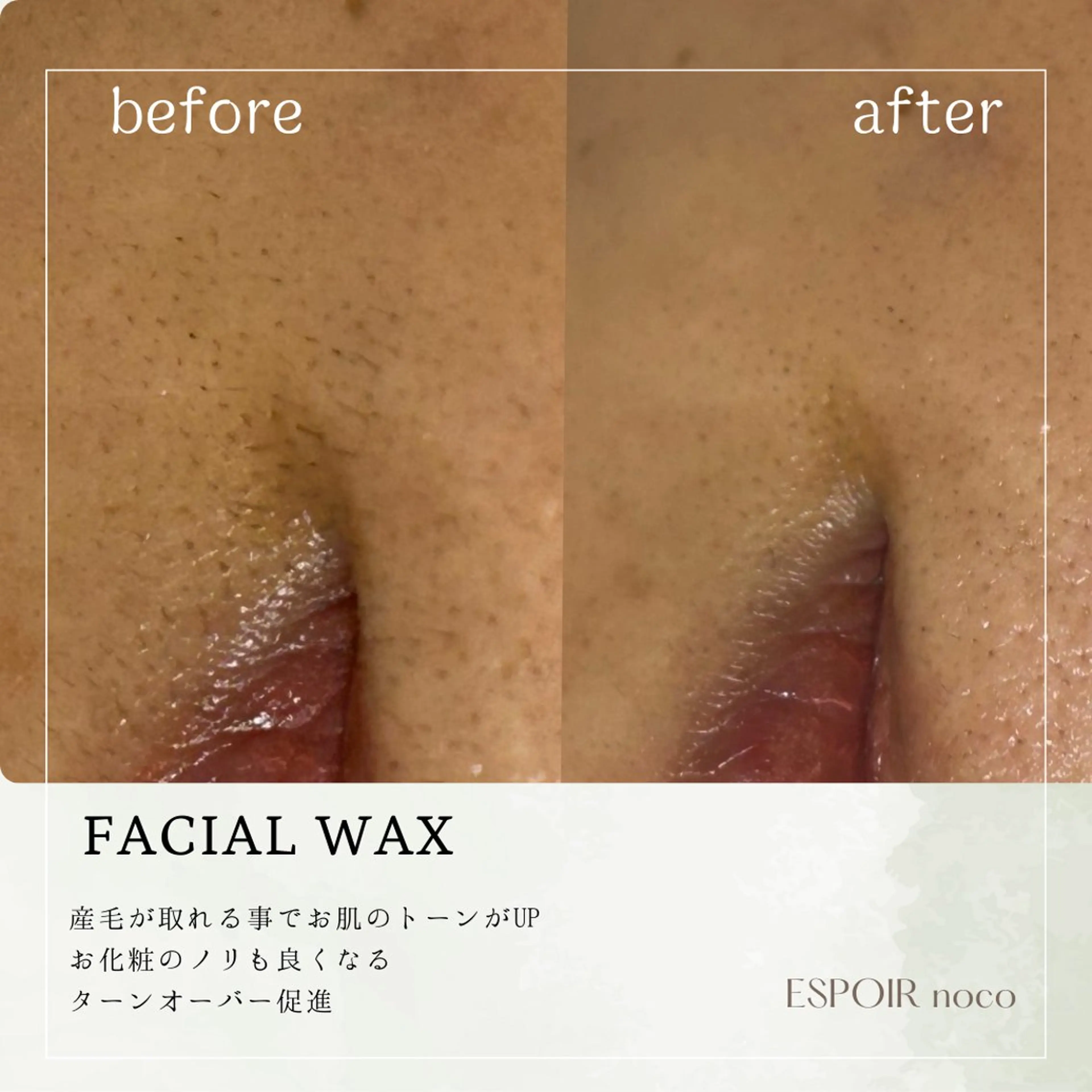 ワックス脱毛🌈 ESPOIRnocoのエステ・リラクイメージ