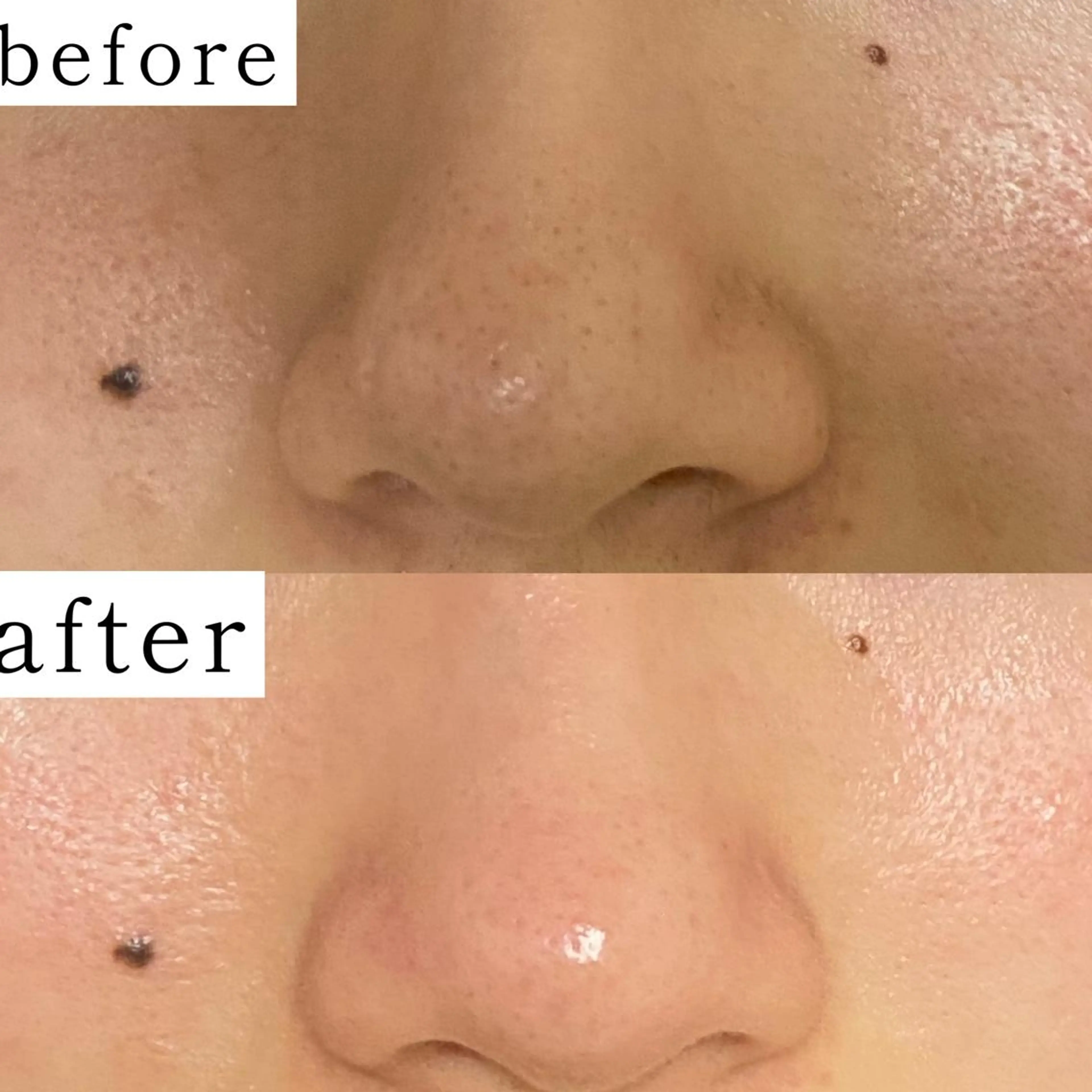 毛穴専門サロン　フルール所属・フルールFululu 自由が丘のエステ・リラクイメージ