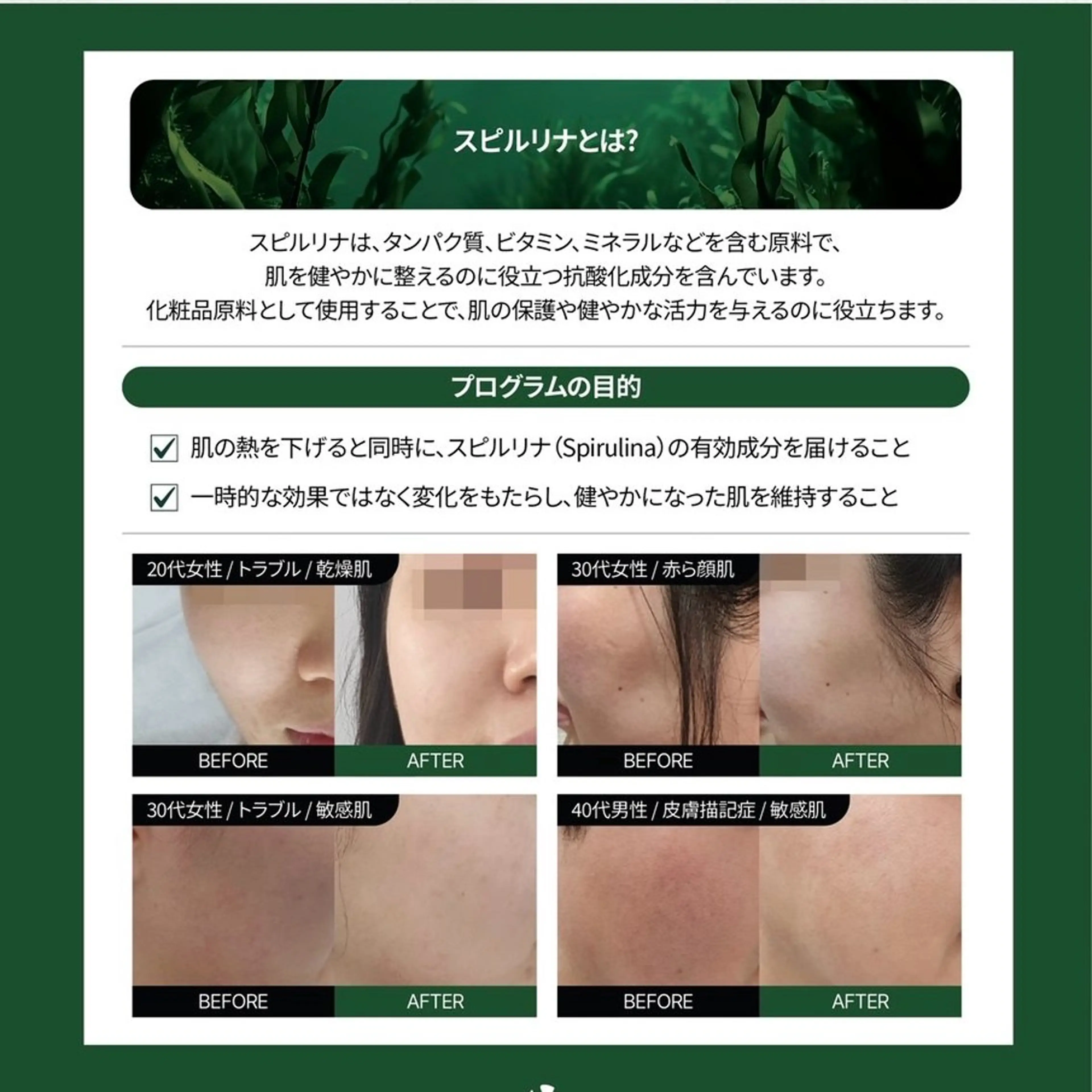 エステ リラク crescent所属・【韓国肌管理・脱毛】 クレセントのエステ・リラクイメージ