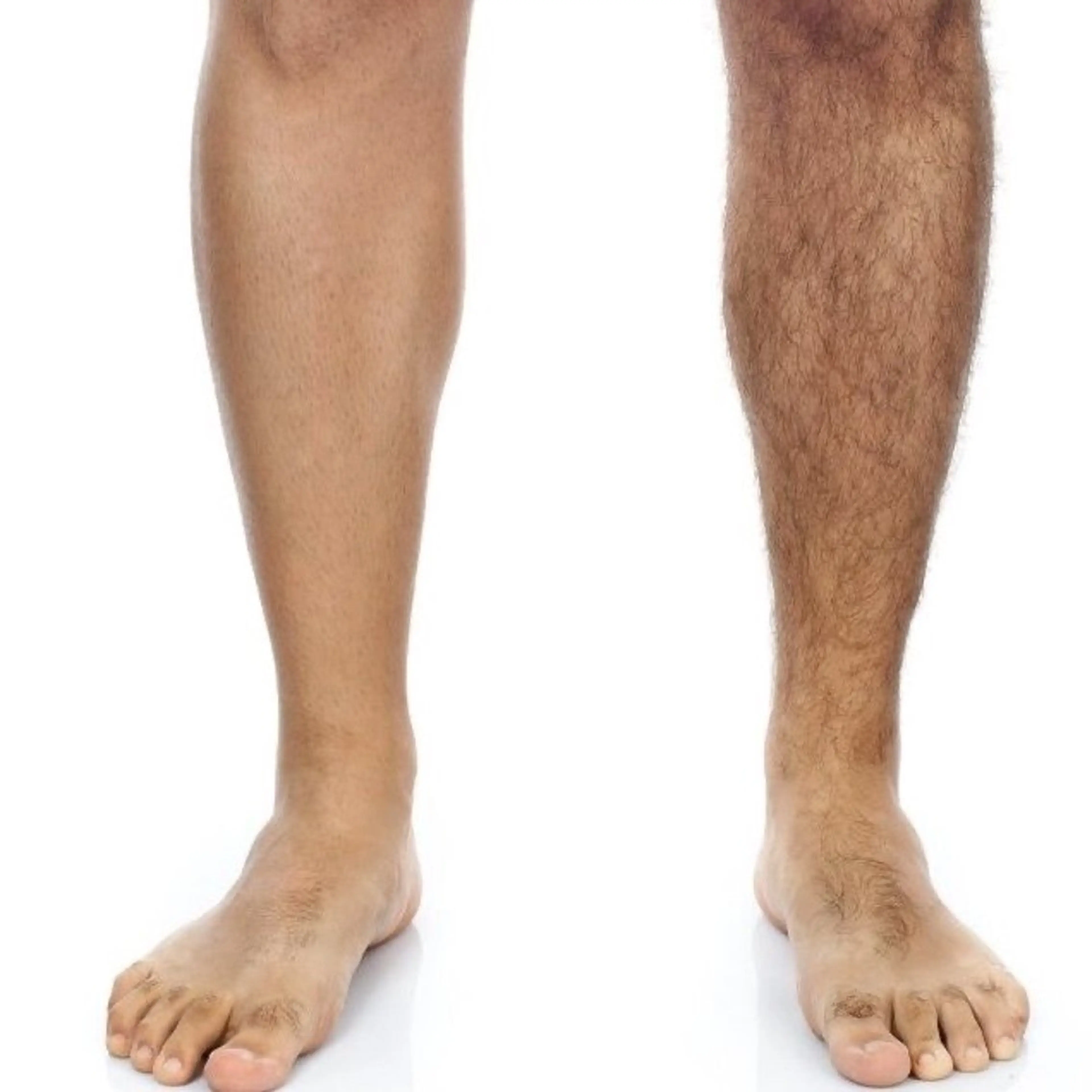 脱毛 小澤 joieange京橋のエステ・リラクイメージ