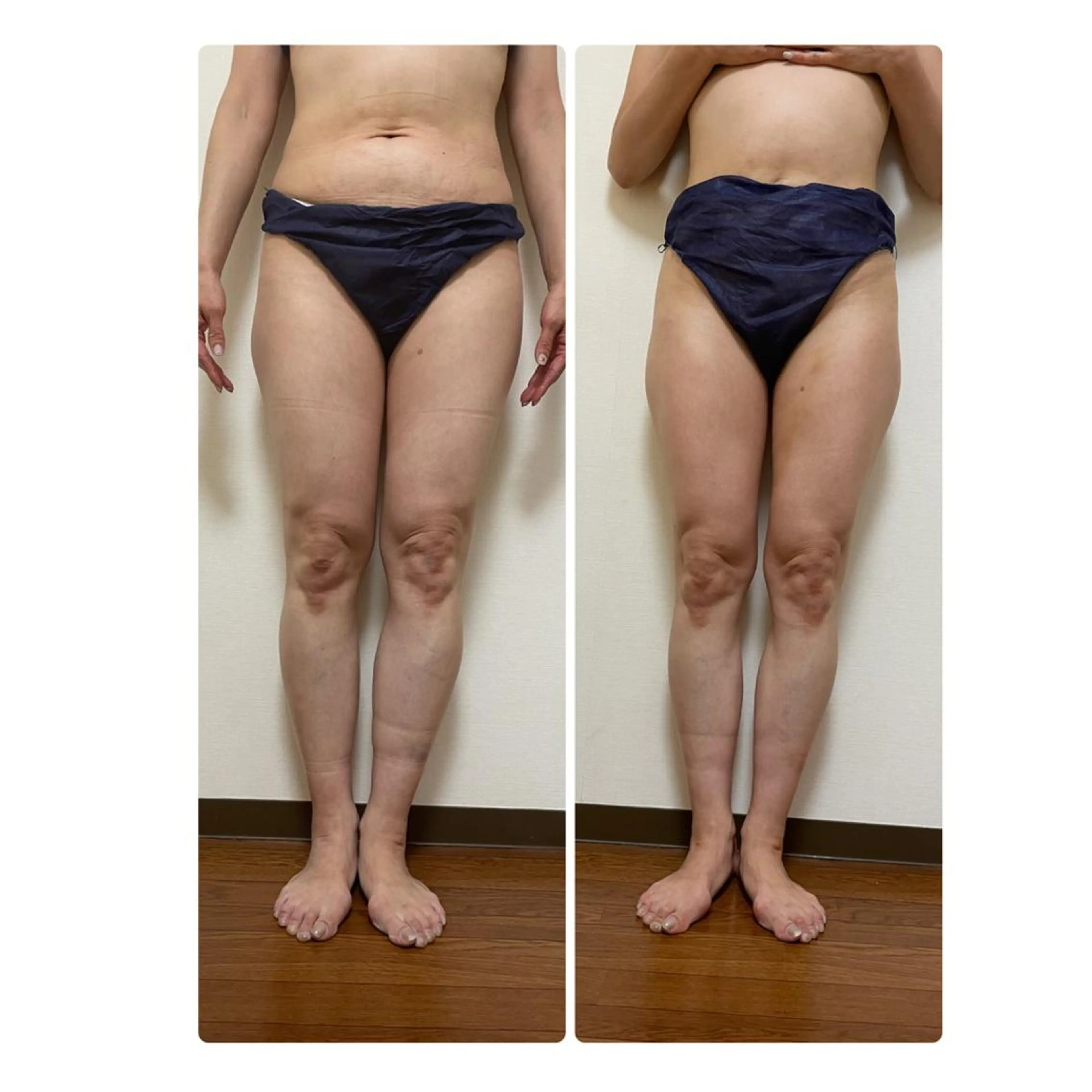 超悶絶サロンひまわり所属・村岸 恵美のエステ・リラクイメージ